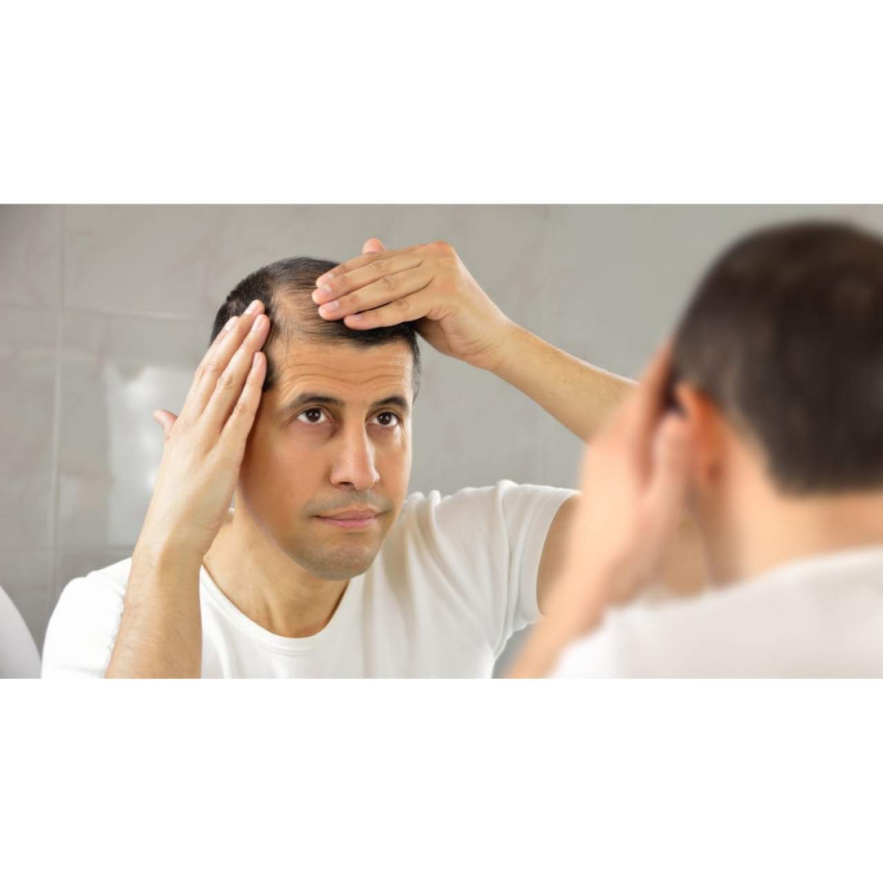 Prevenir la caída del cabello en Barcelona: Dr. Carlos Zito