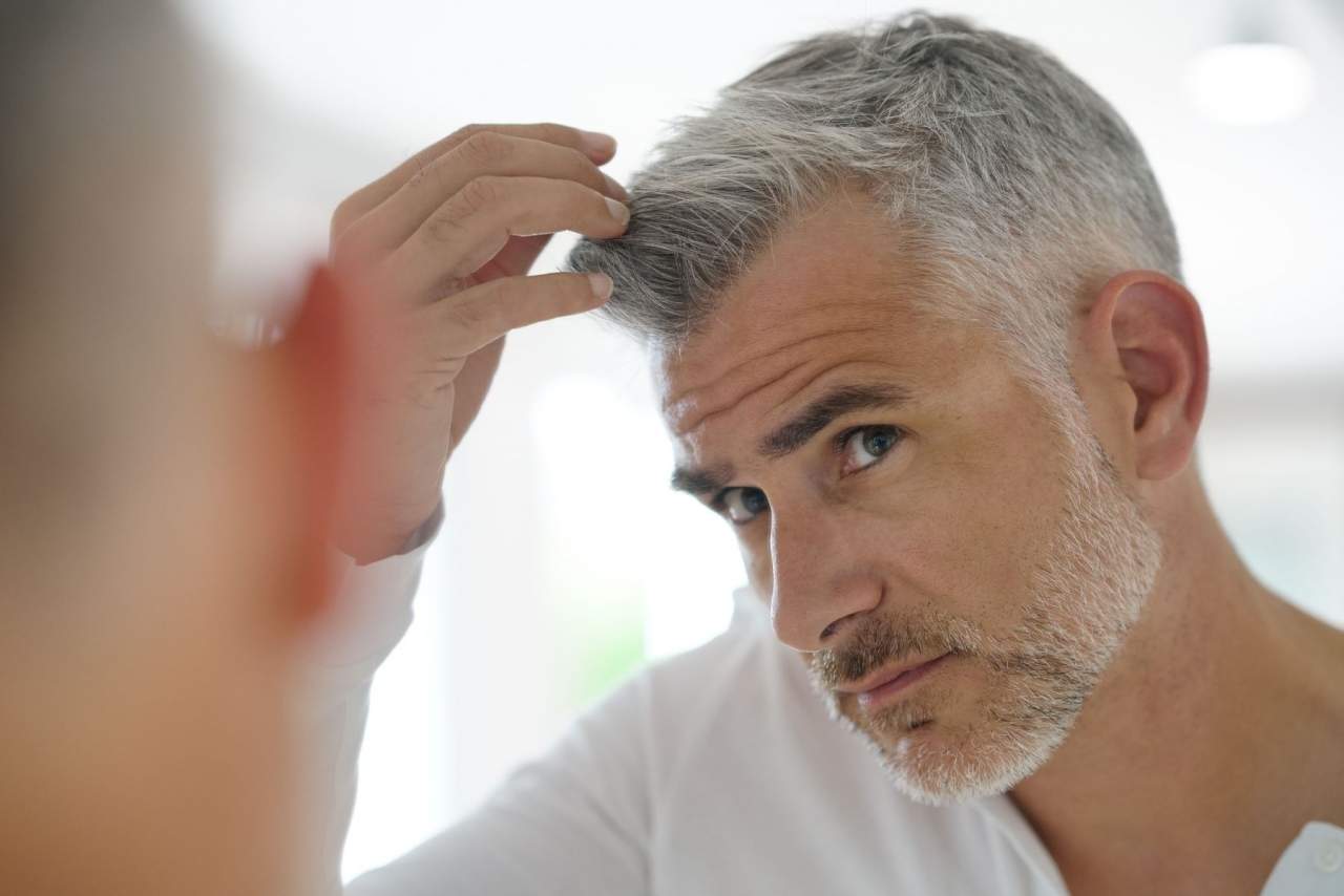 ¿Son las prótesis capilares a medida el futuro?: Soluciones de My Special Hair