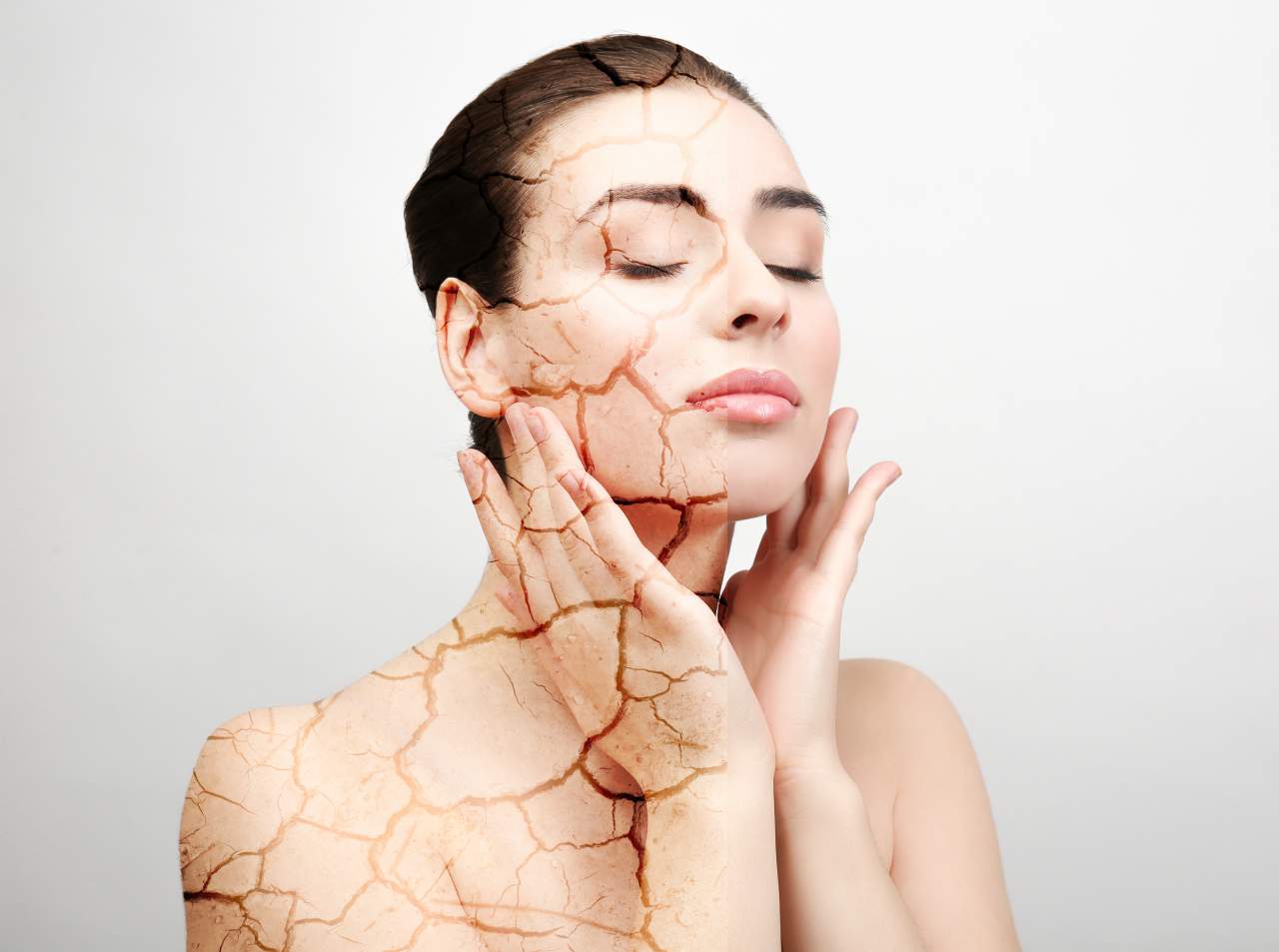 Microneedling: la técnica de Montserrat Travé para rejuvenecer el rostro