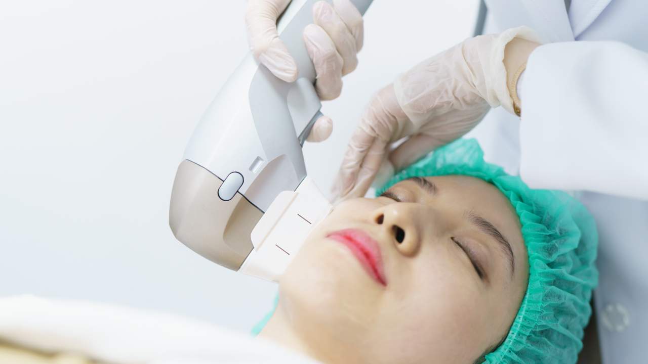 ¿Qué es el tratamiento Slim Fit Medical y HIFU? La novedad en estética