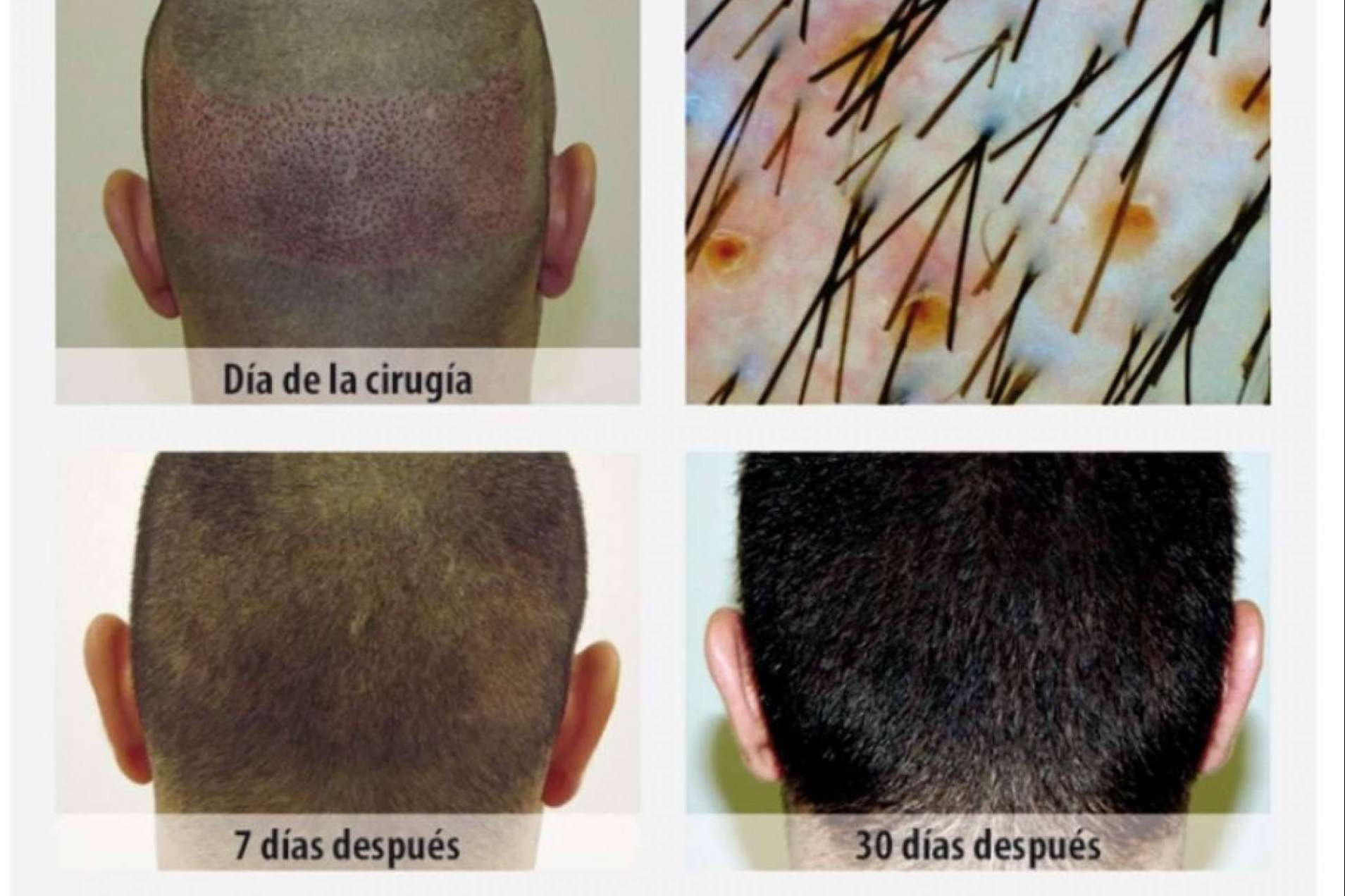 Clínica Dr.Pelo: ¿Cuál es la mejor clínica de injerto capilar en Sevilla?