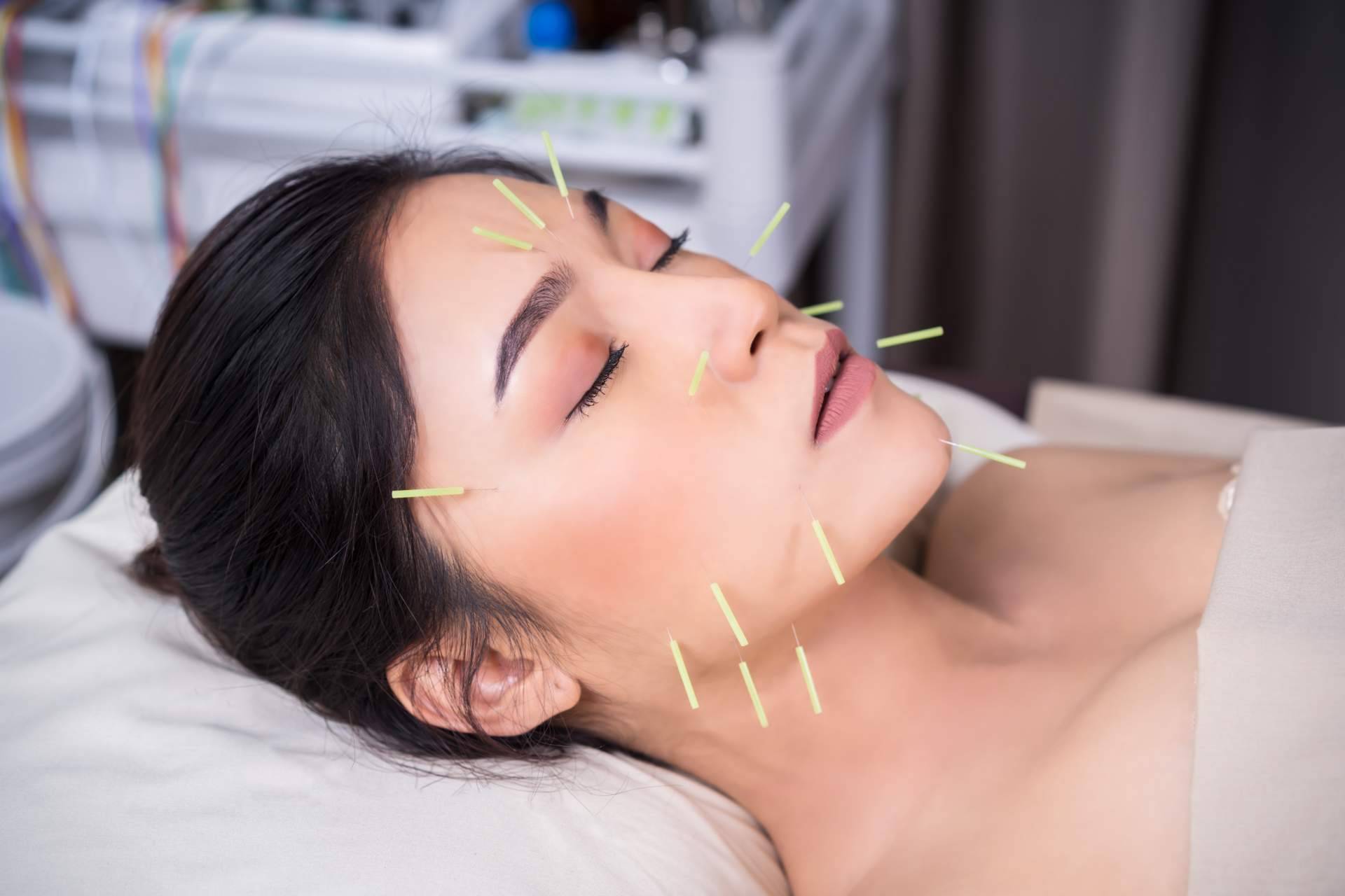 Kikai: acupuntura estética a domicilio por el centro
