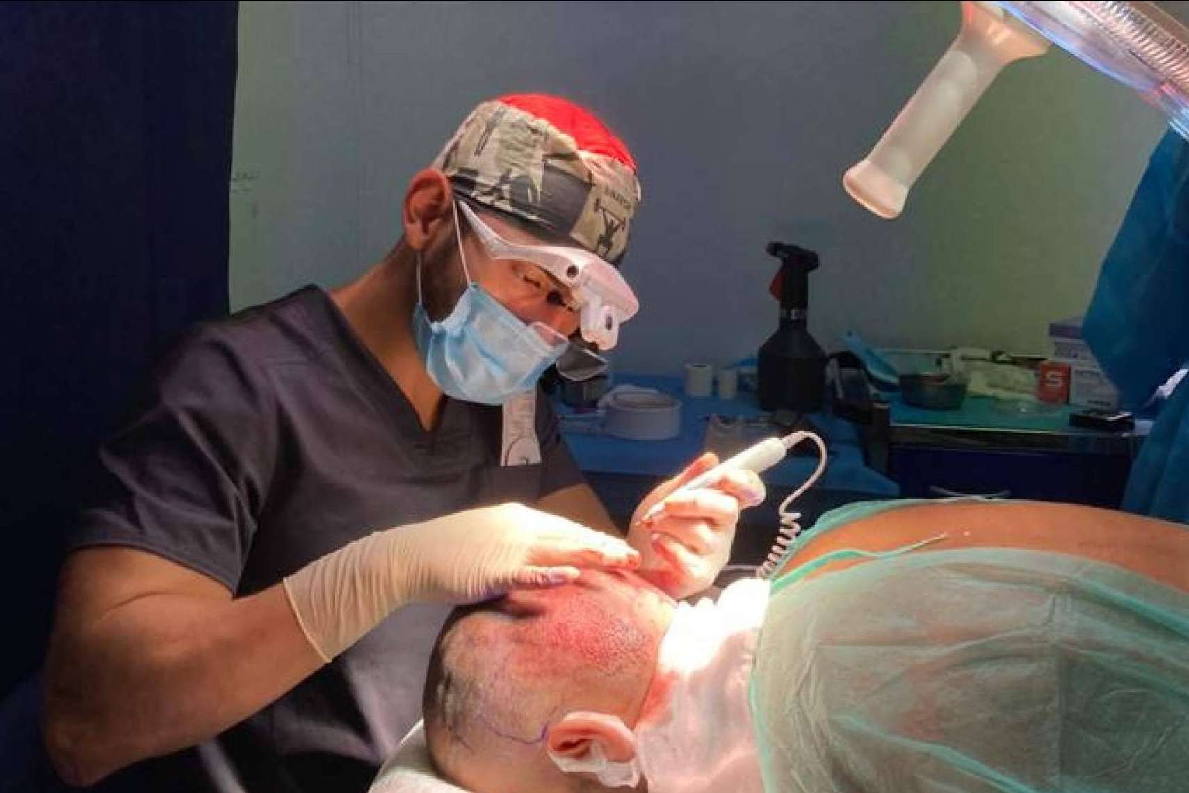 Doctor Bern: ¿A qué edad se recomienda realizar un injerto capilar?