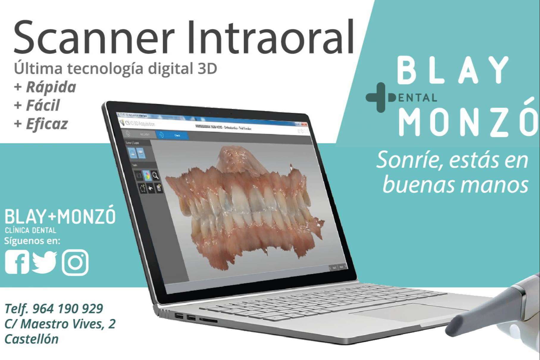 Las técnicas avanzadas en implantología de Clínica Blay Monzó: expertos en odontología digital