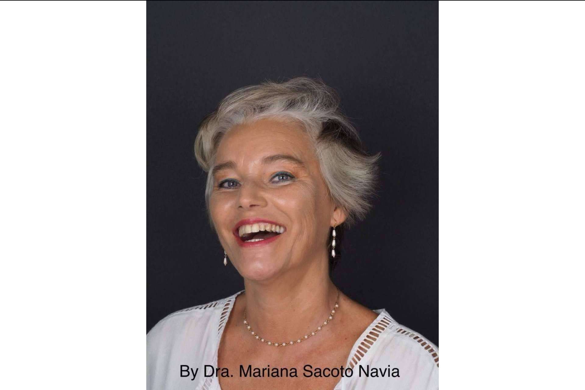 Invisalign® se consolida como la ortodoncia para diseñar sonrisas