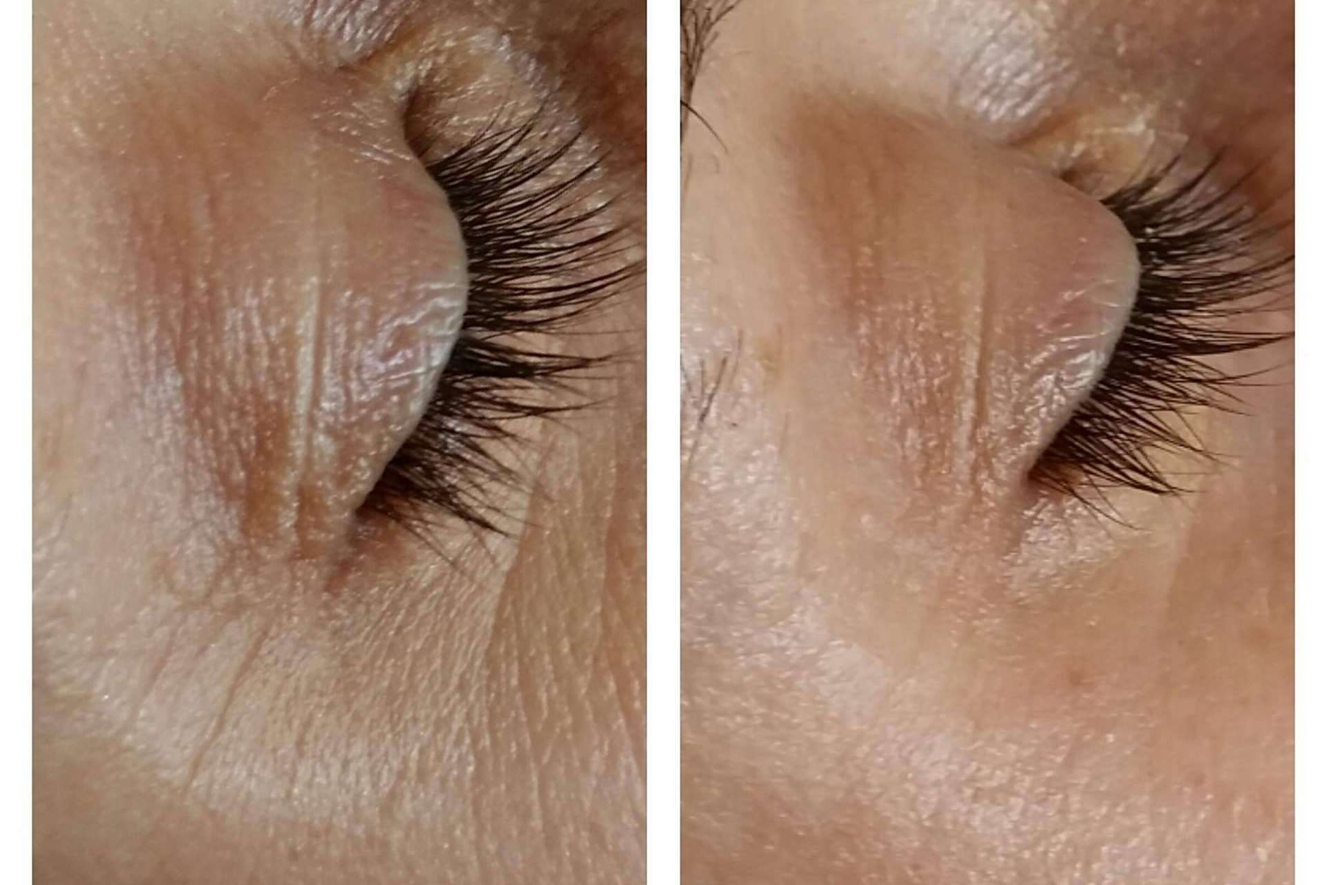 Conseguir una piel de porcelana con tratamiento facial antimanchas y otros tratamientos faciales icónicos de la compañía MiCleo&Co