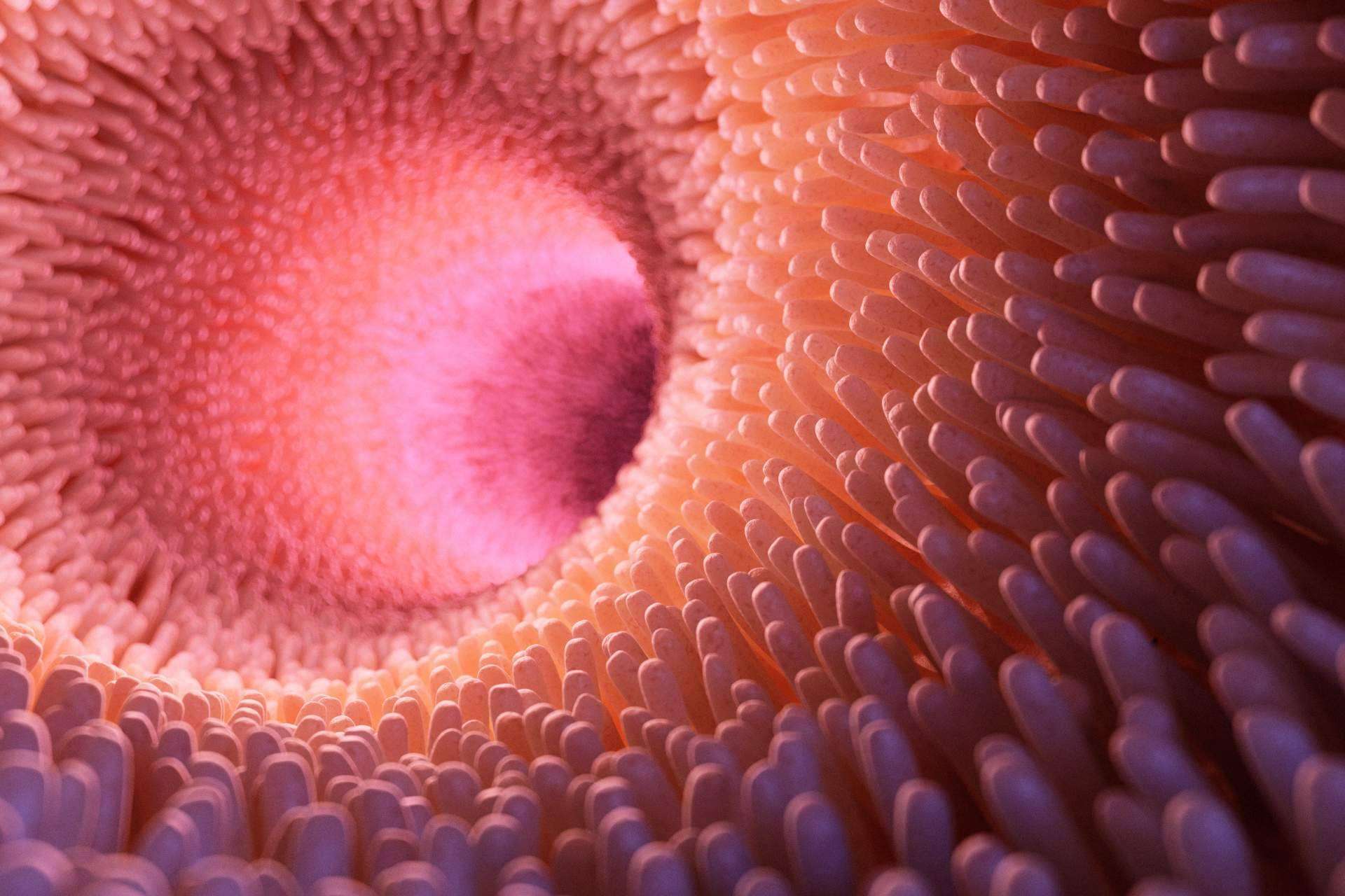 ¿La disbiosis intestinal tiene cura?