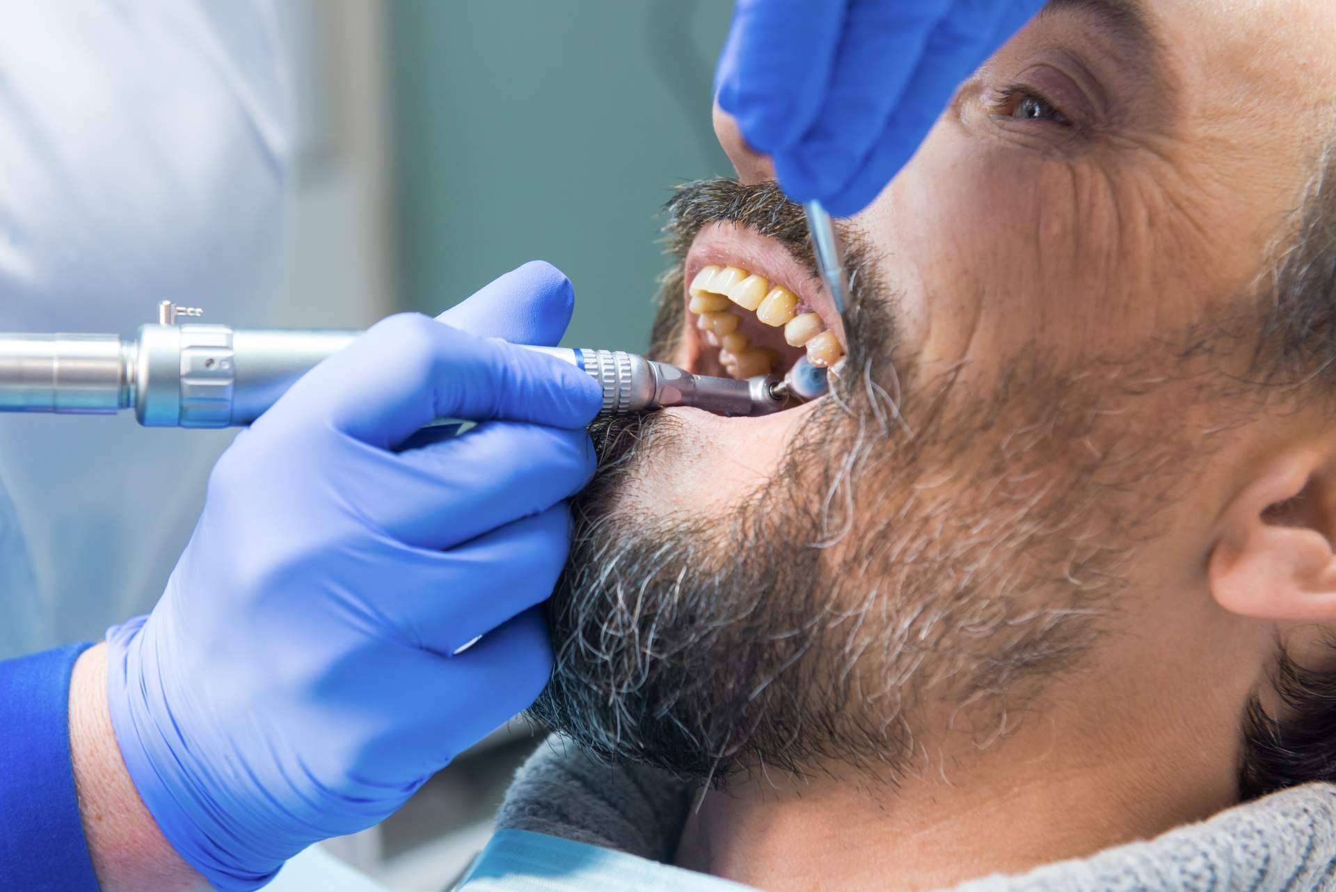 ¿Cómo se hacen limpiezas dentales profesionales?, por Helident Clínica Dental