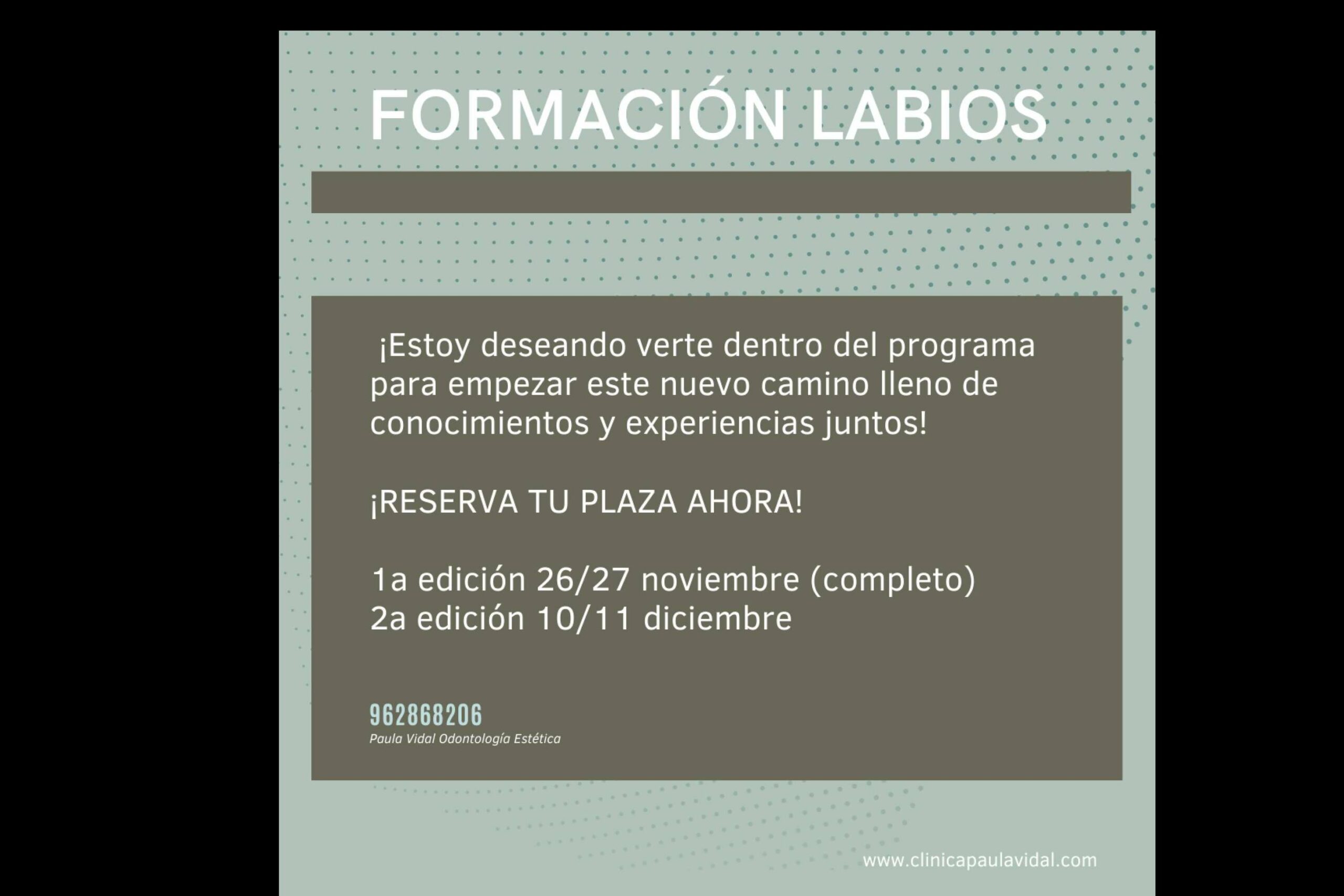 Curso para odontólogos de relleno de ácido hialurónico, por Clínica Paula Vidal