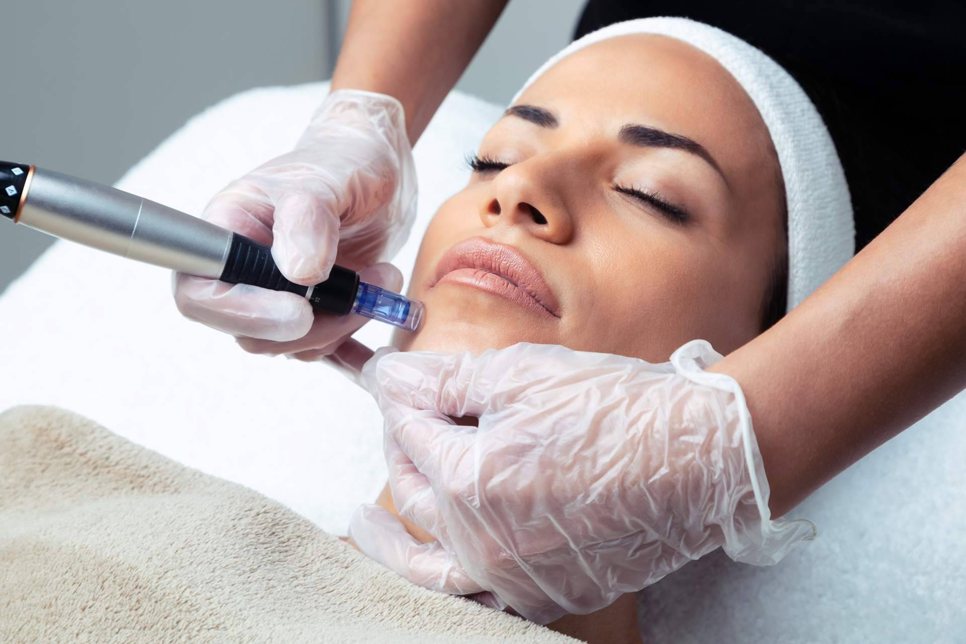 Policlínica ICD ofrece tratamiento de mesoterapia BIO para rejuvenecer la piel y activar su regeneración