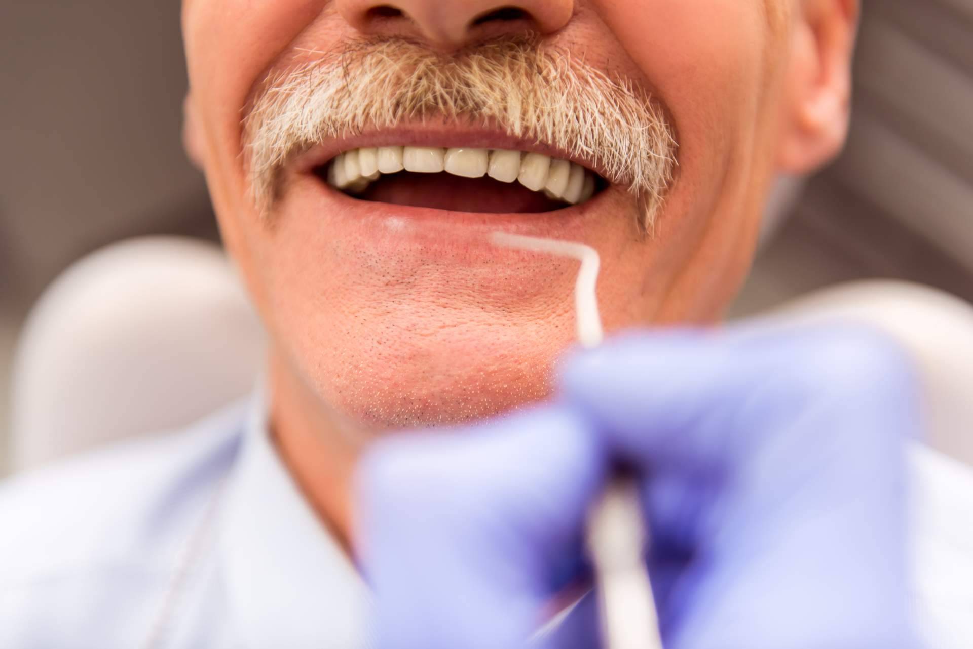Los implantes cigomáticos de la clínica Corrales Dental