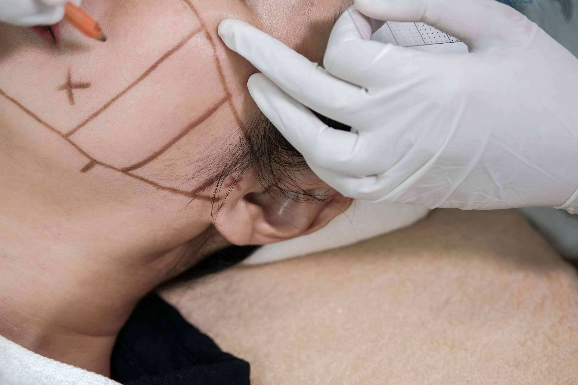 CB Clinic opta por HIFU Facial con Ultrasonidos