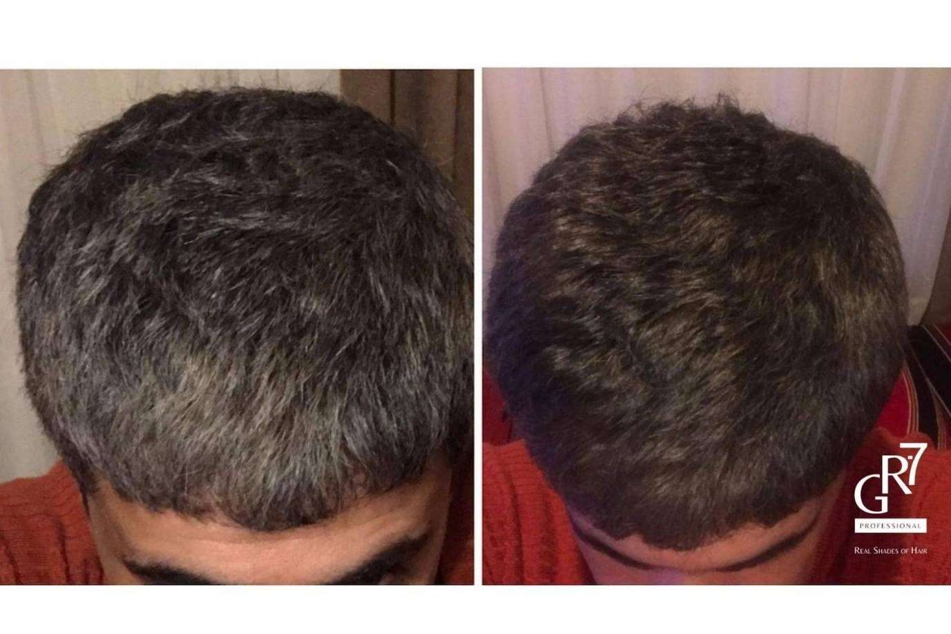 Despejar dudas acerca de la loción profesional para canas GR-7