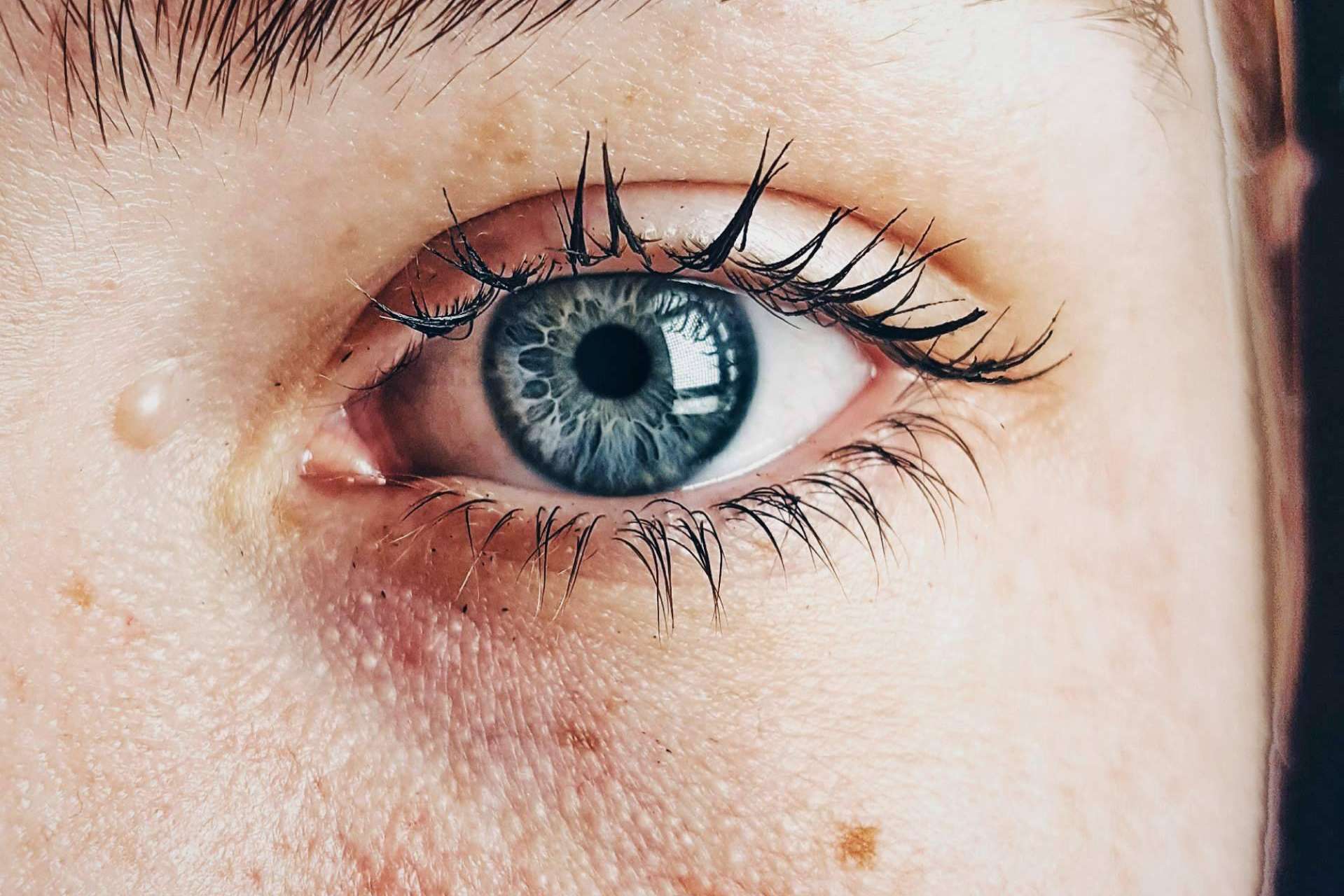 ¿Cómo evitar el síndrome de ojo seco con una higiene ocular adecuada?