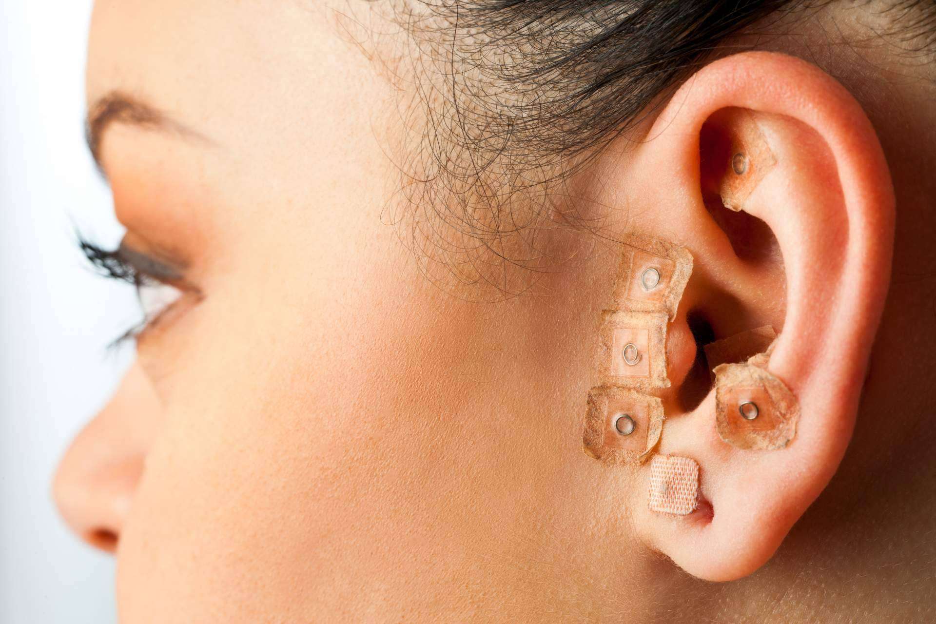 Auriculoterapia, técnica natural de la mano de Rambla 6 que ayuda en el tratamiento del dolor, ansiedad y adicciones