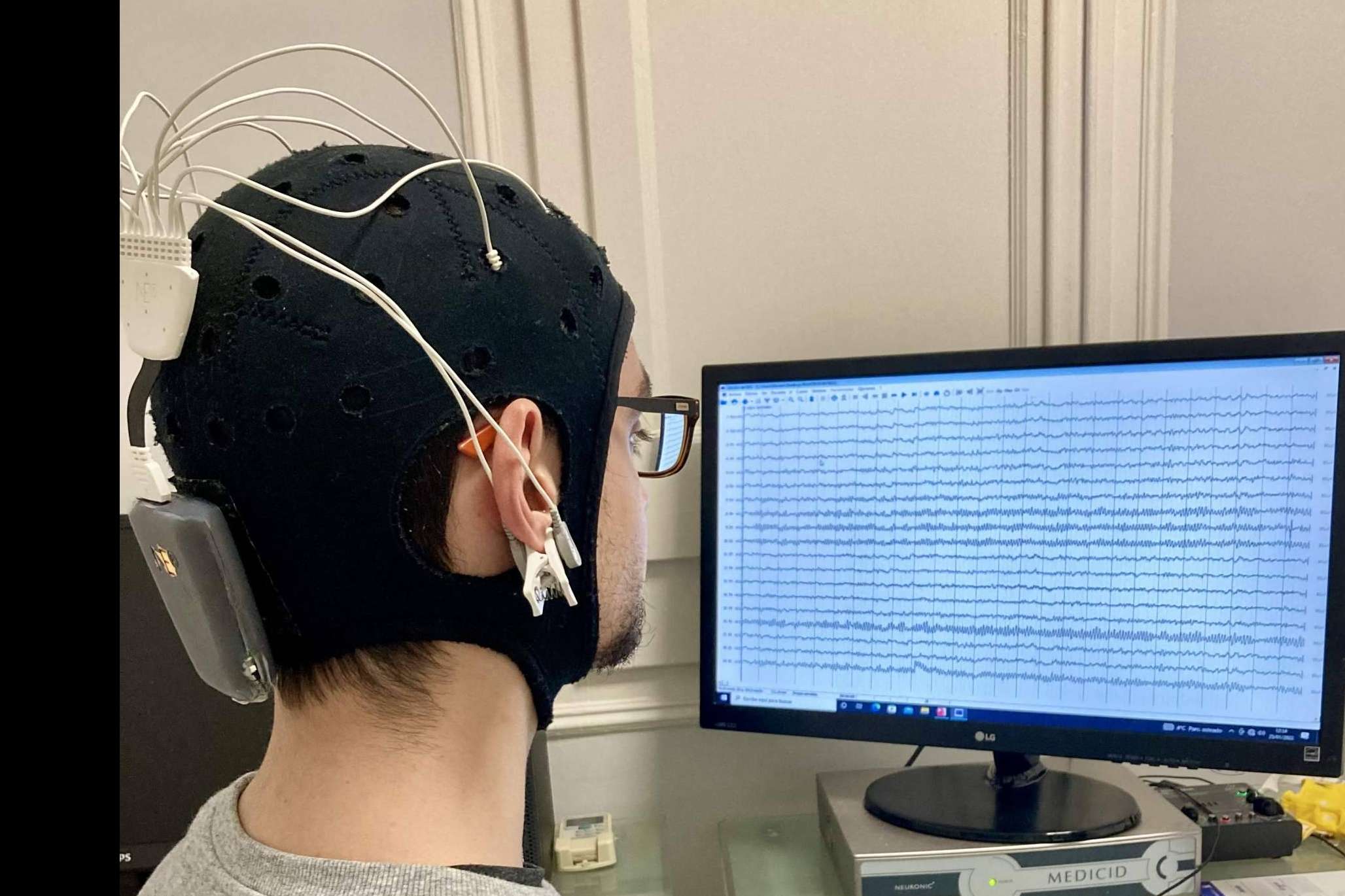 Los tratamientos de neuromodulación ayudan a la recuperación tras sufrir un ictus