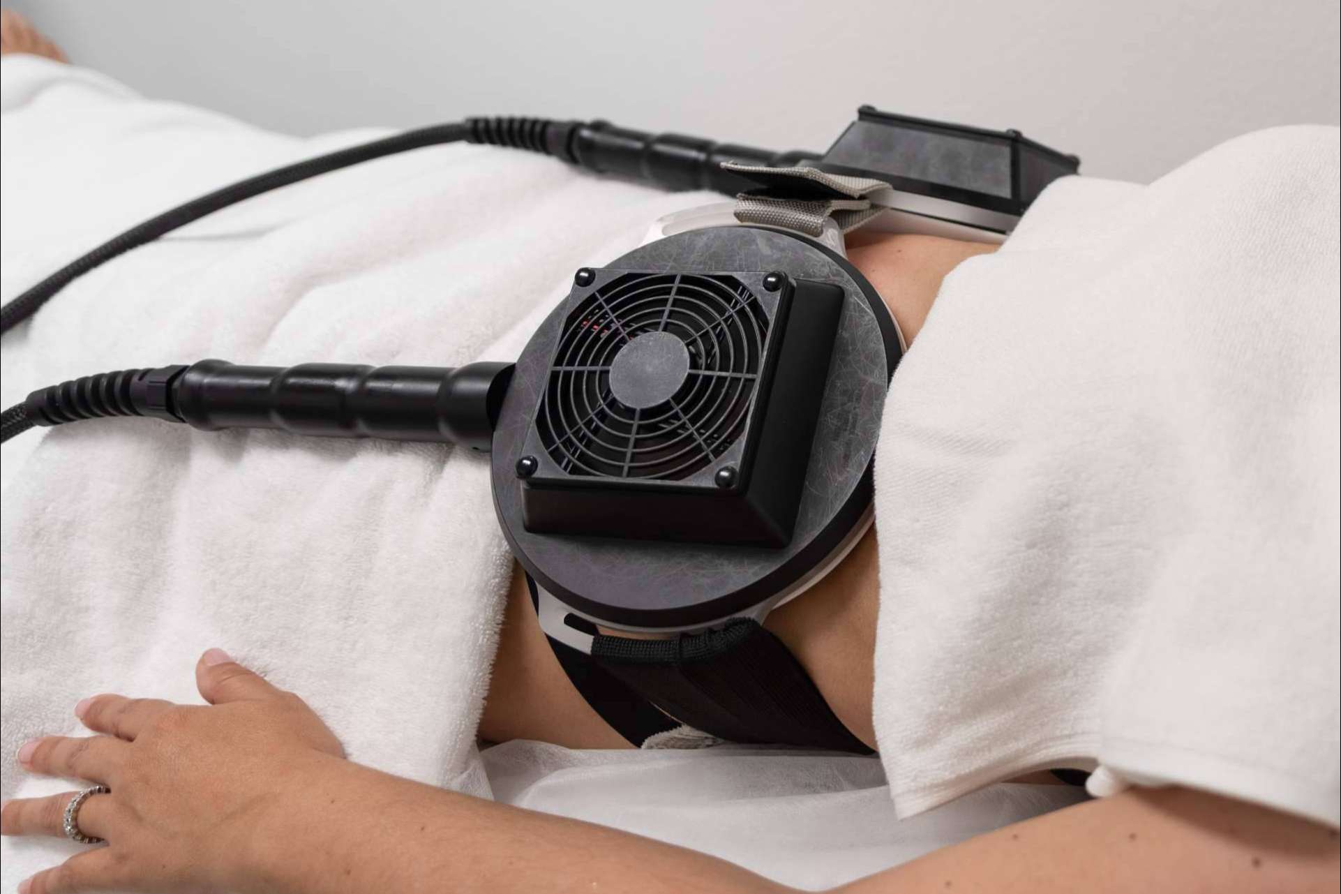 Reducir la grasa localizada con tratamientos combinados de criolipólisis y estimulación electromagnética