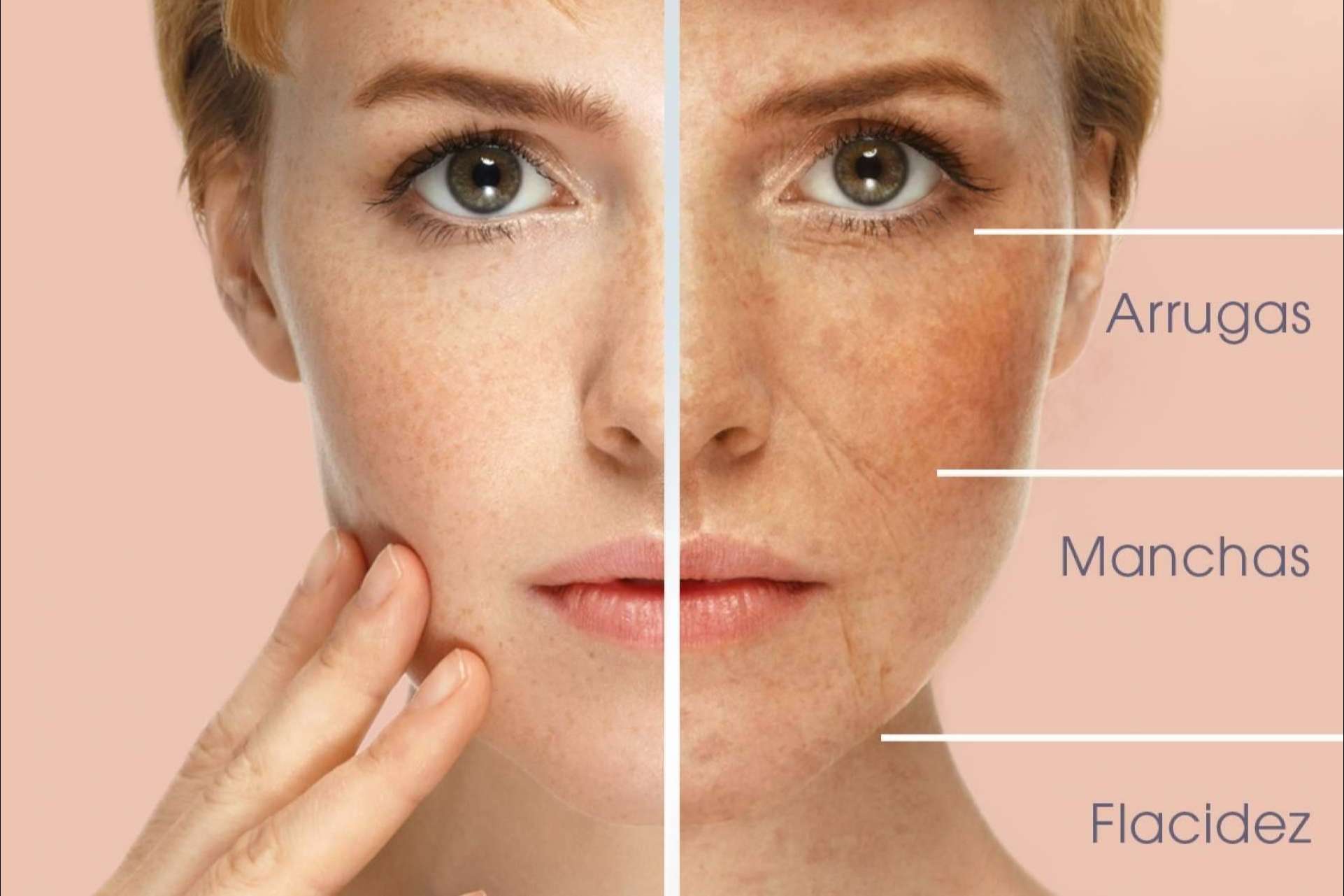 Combatir los signos del envejecimiento con el PRP facial de KōAN Club