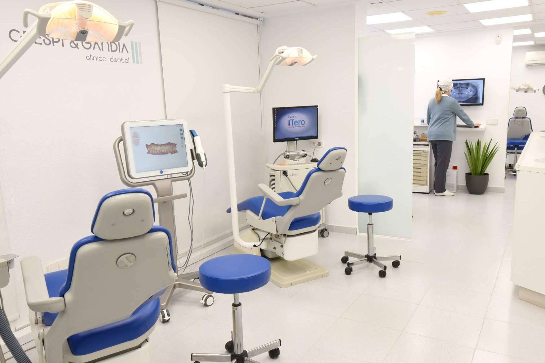 Carillas dentales, la forma de recuperar la estética de la sonrisa en un día