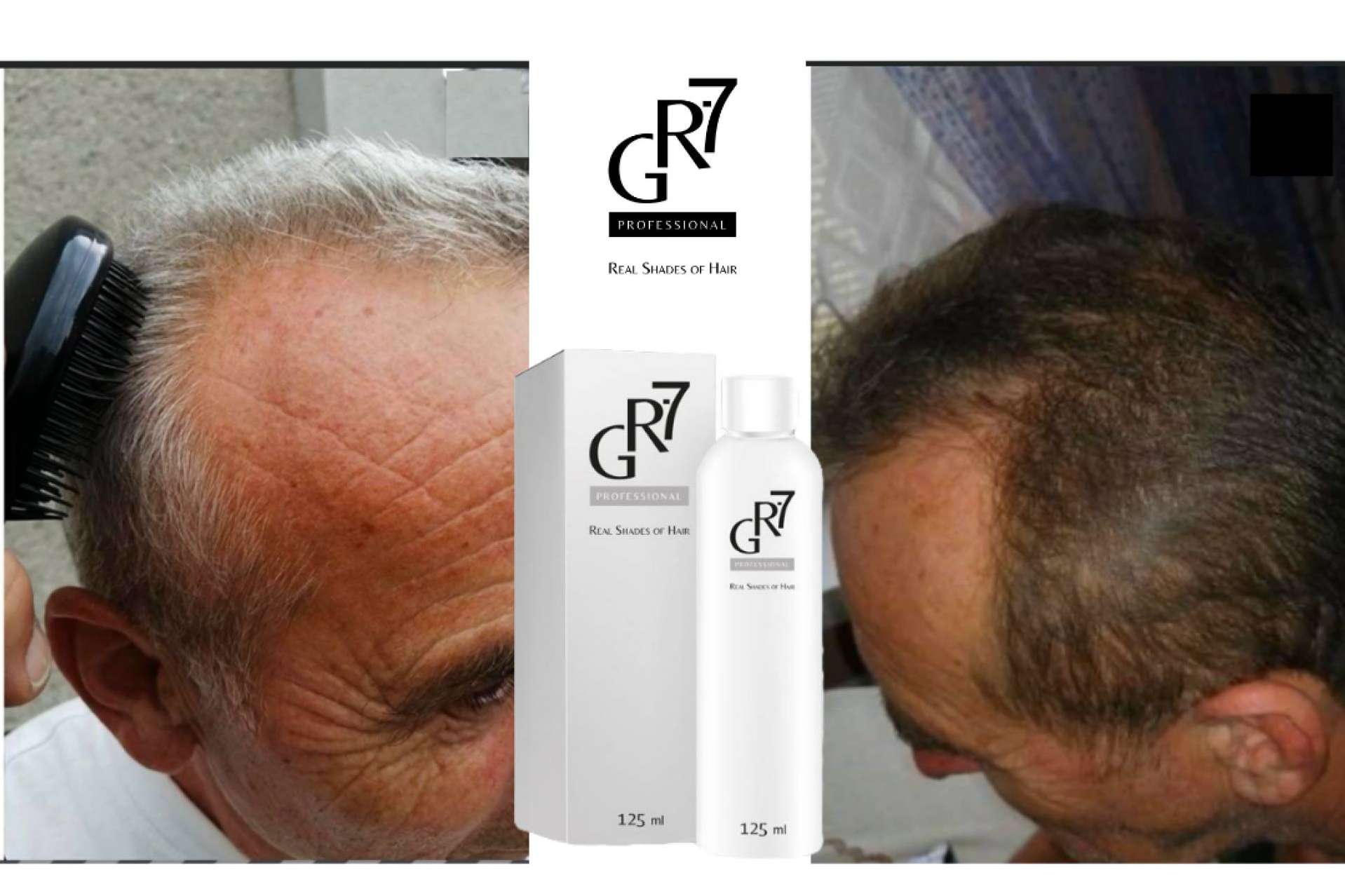 ¿Cómo afectan los aminoácidos a la salud capilar?, tapar canas sin tinte con GR-7