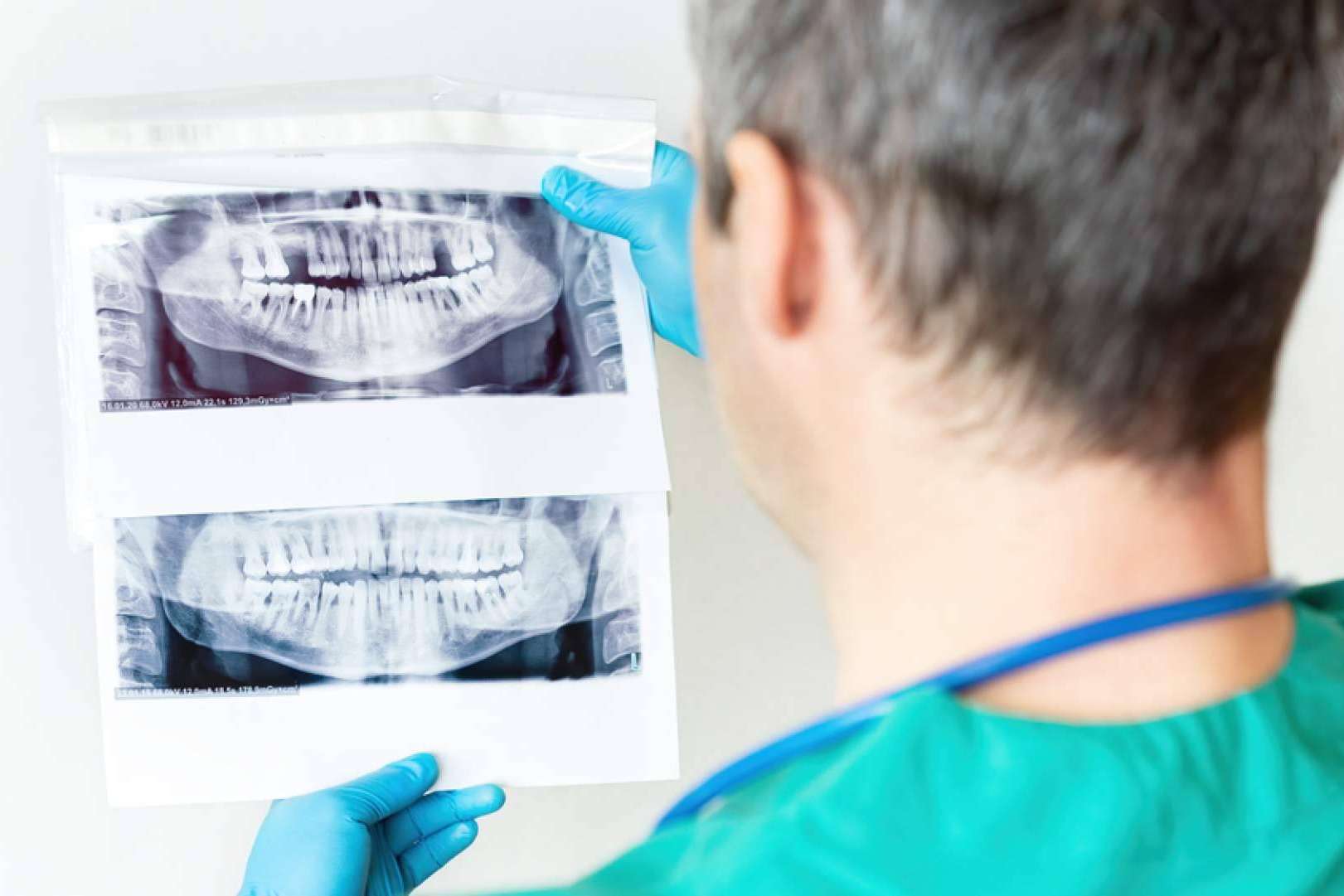 Conseguir una sonrisa perfecta con DeltaDent, la clínica dental de Chamartín