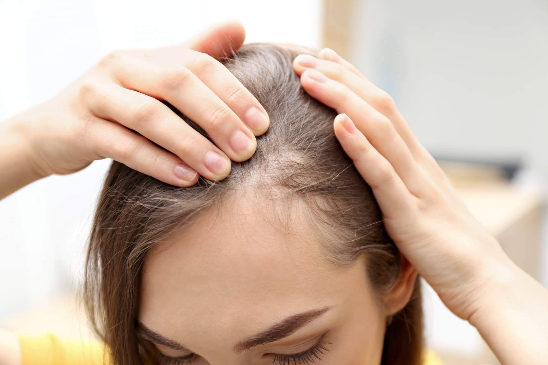 Especialistas en cualquier tipo de alopecia femenina en la clínica Capilar Innovation Clinic