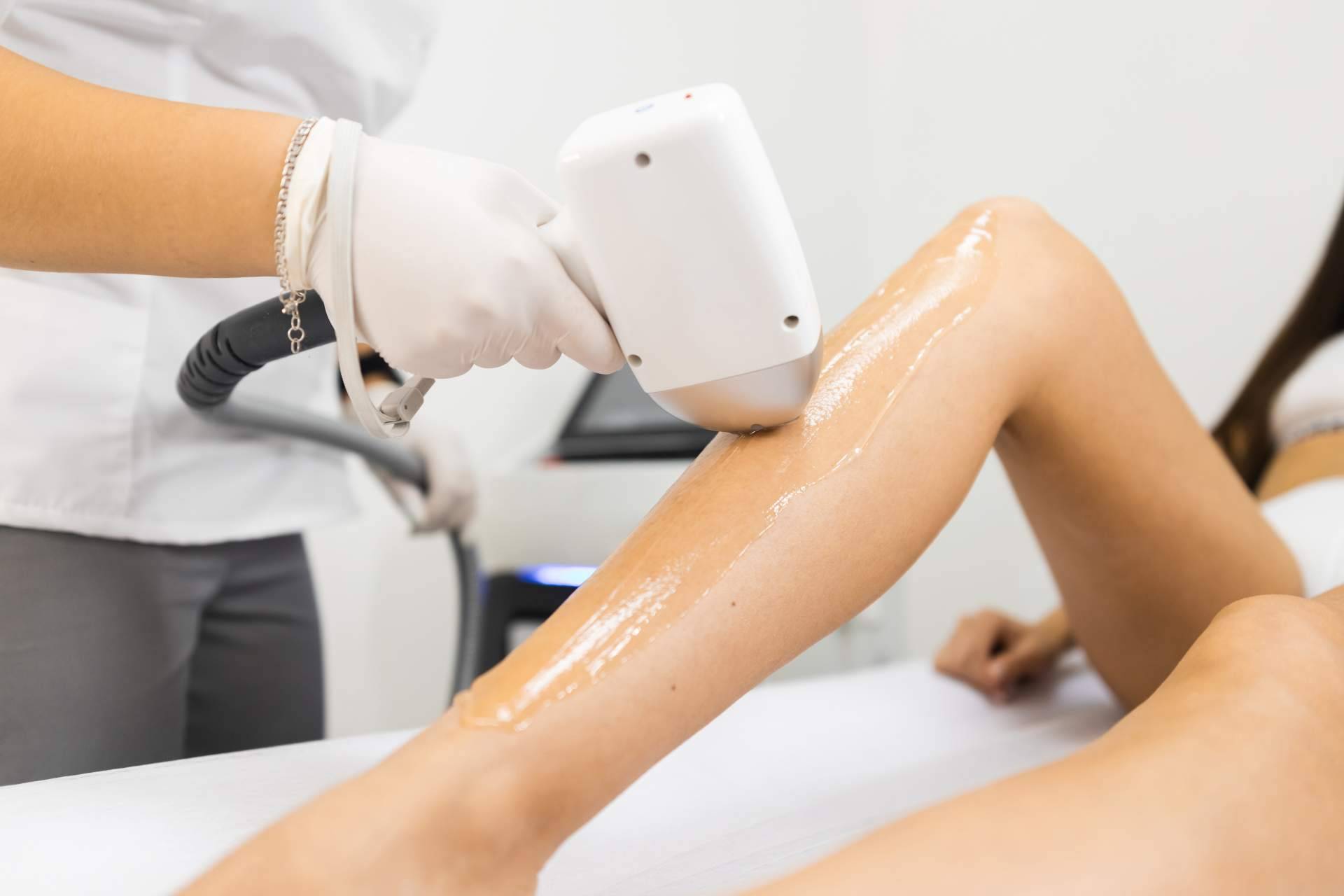 Depilación facial definitiva, de la mano de Dermativa