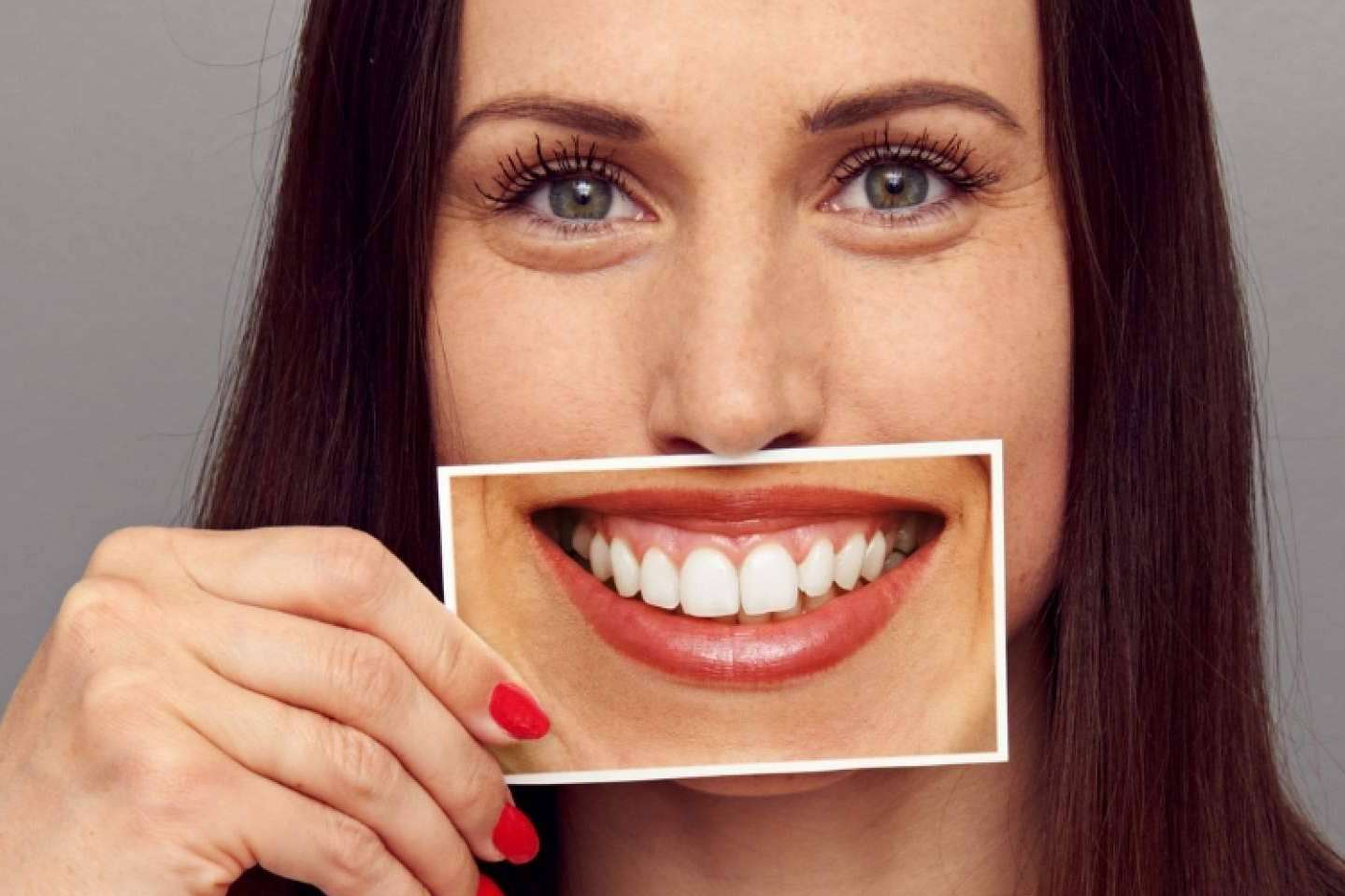 Someterse a un tratamiento para la sonrisa gingival de la mano de la Clínica Dental Ruiz de Gopegui