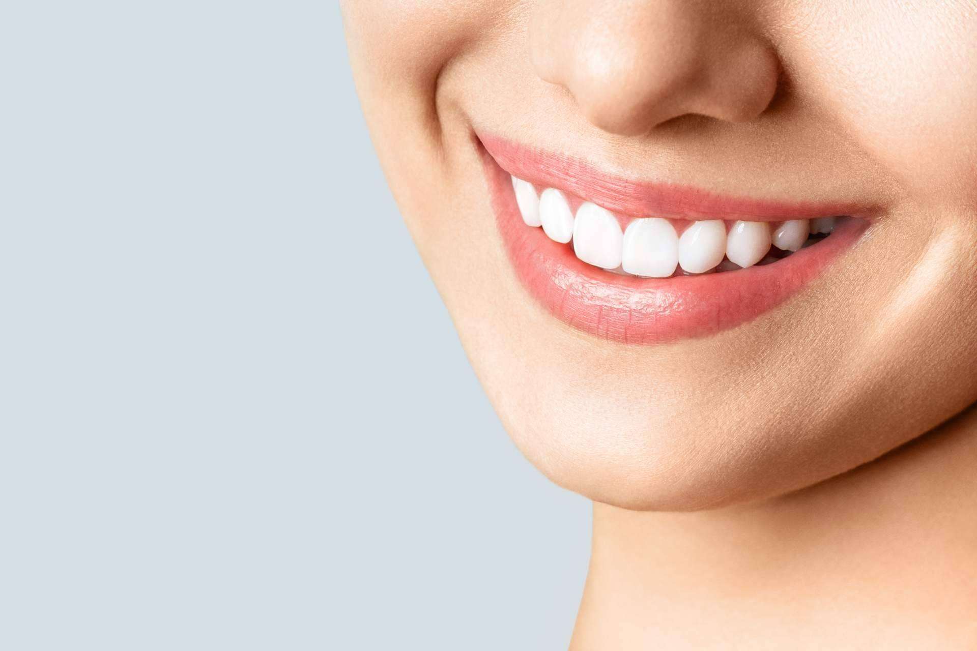 Carlos Saiz Smile es una clínica experta en la aplicación de carillas dentales