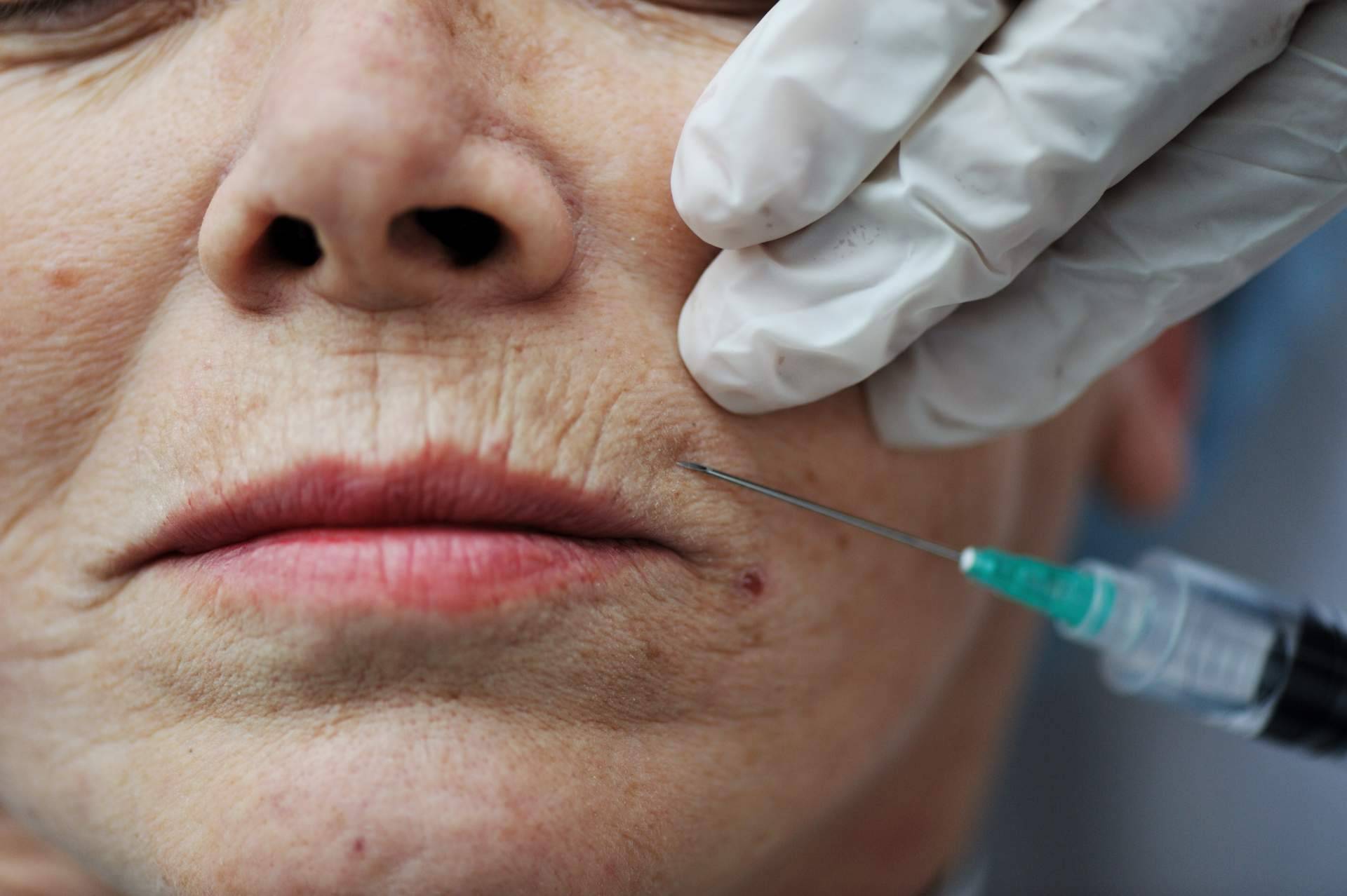 Un envejecimiento saludable y resultados naturales son posibles con la medicina estética y well aging