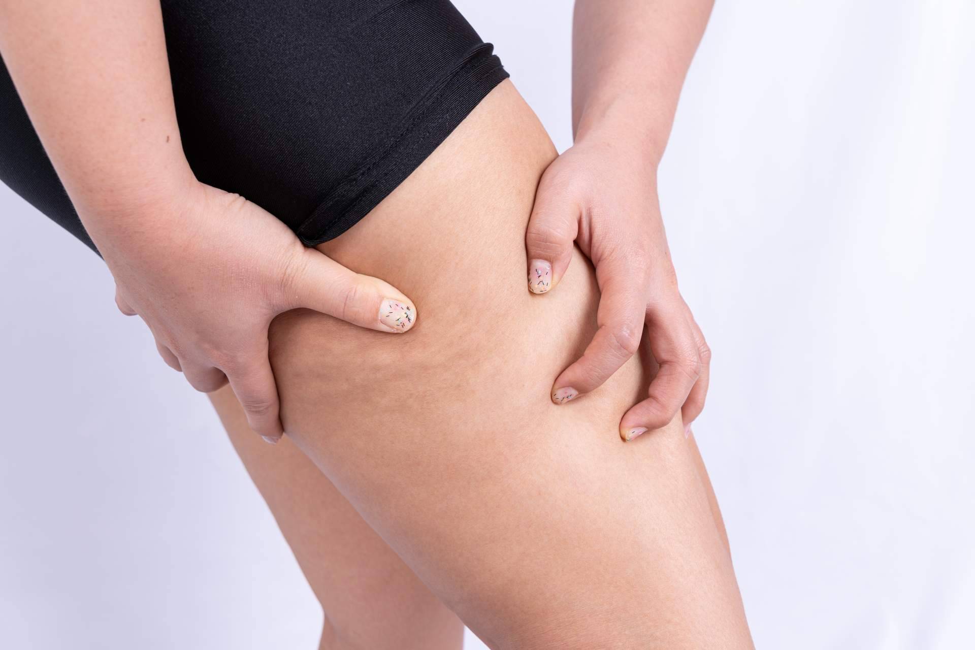 Vacuslim 48, tratamiento corporal para tratar y reducir la celulitis ¿Realmente funciona?