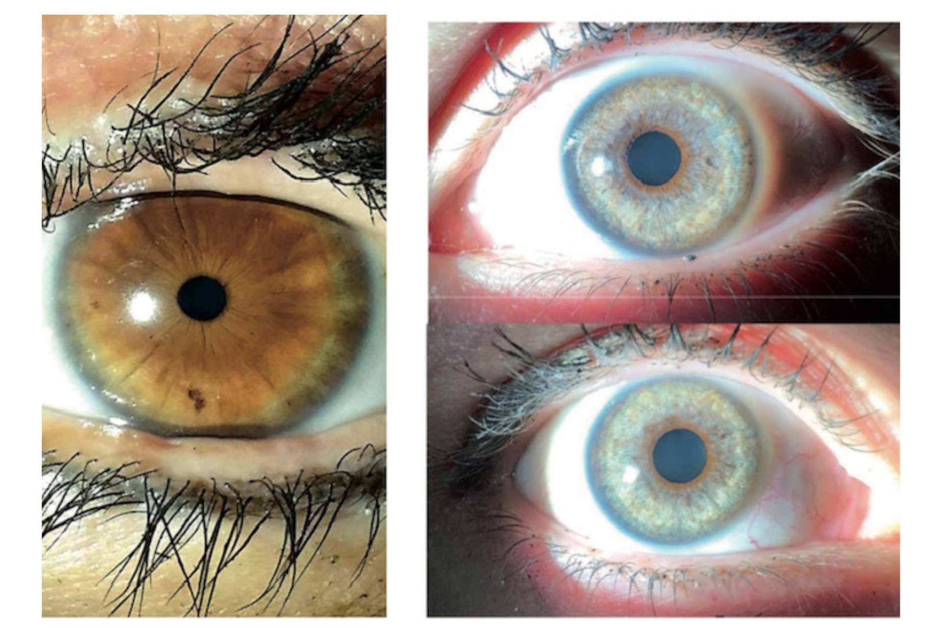 Los productos crece pestañas pueden oscurecer los ojos, por Clínica Eyecos