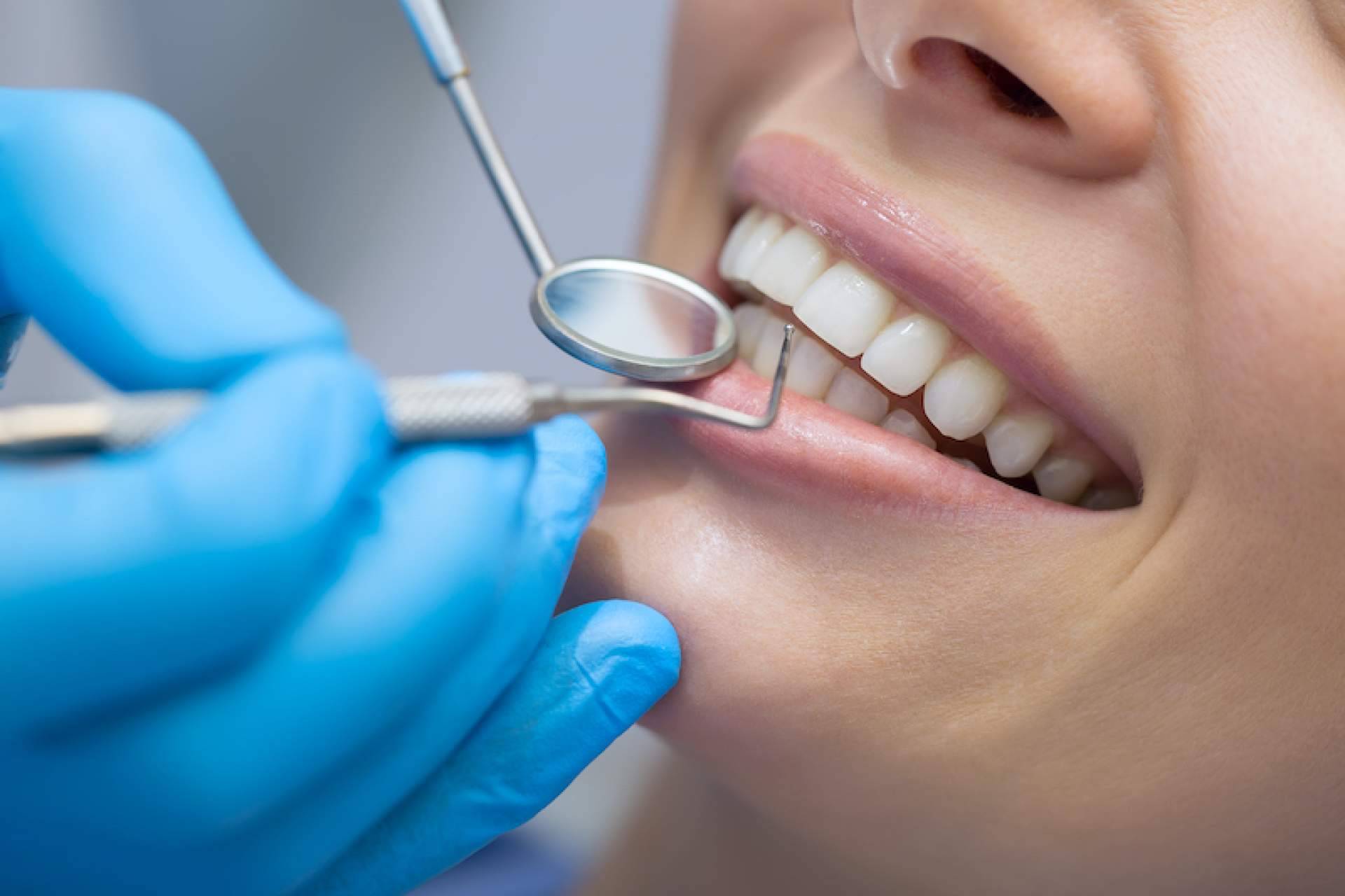 Dónde y cómo conseguir los dientes perfectos