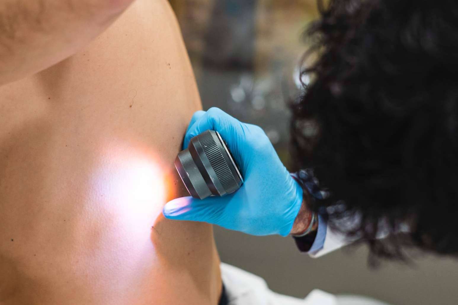 Protección ante los melanomas con buenos hábitos al sol como medida de protección