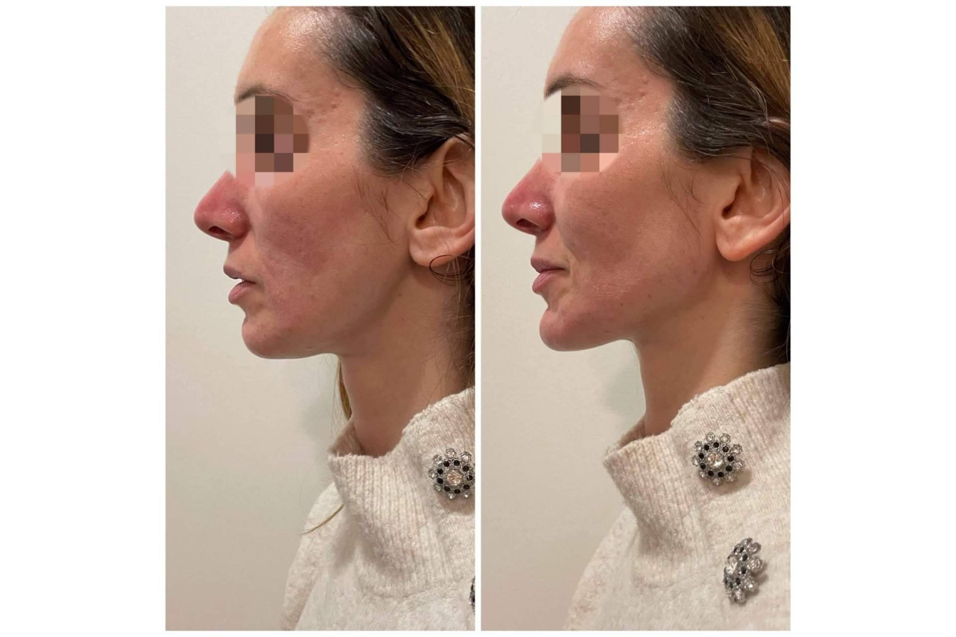 Dónde y por qué realizarse una marcación mandibular, con Cecilia Arthur