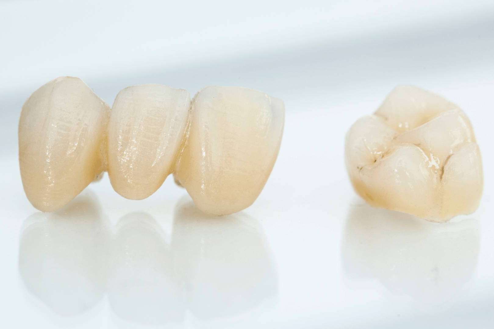 La Clínica Dental Ruiz de Gopegui coloca coronas dentales, una solución duradera y estética para recuperar la sonrisa perfecta