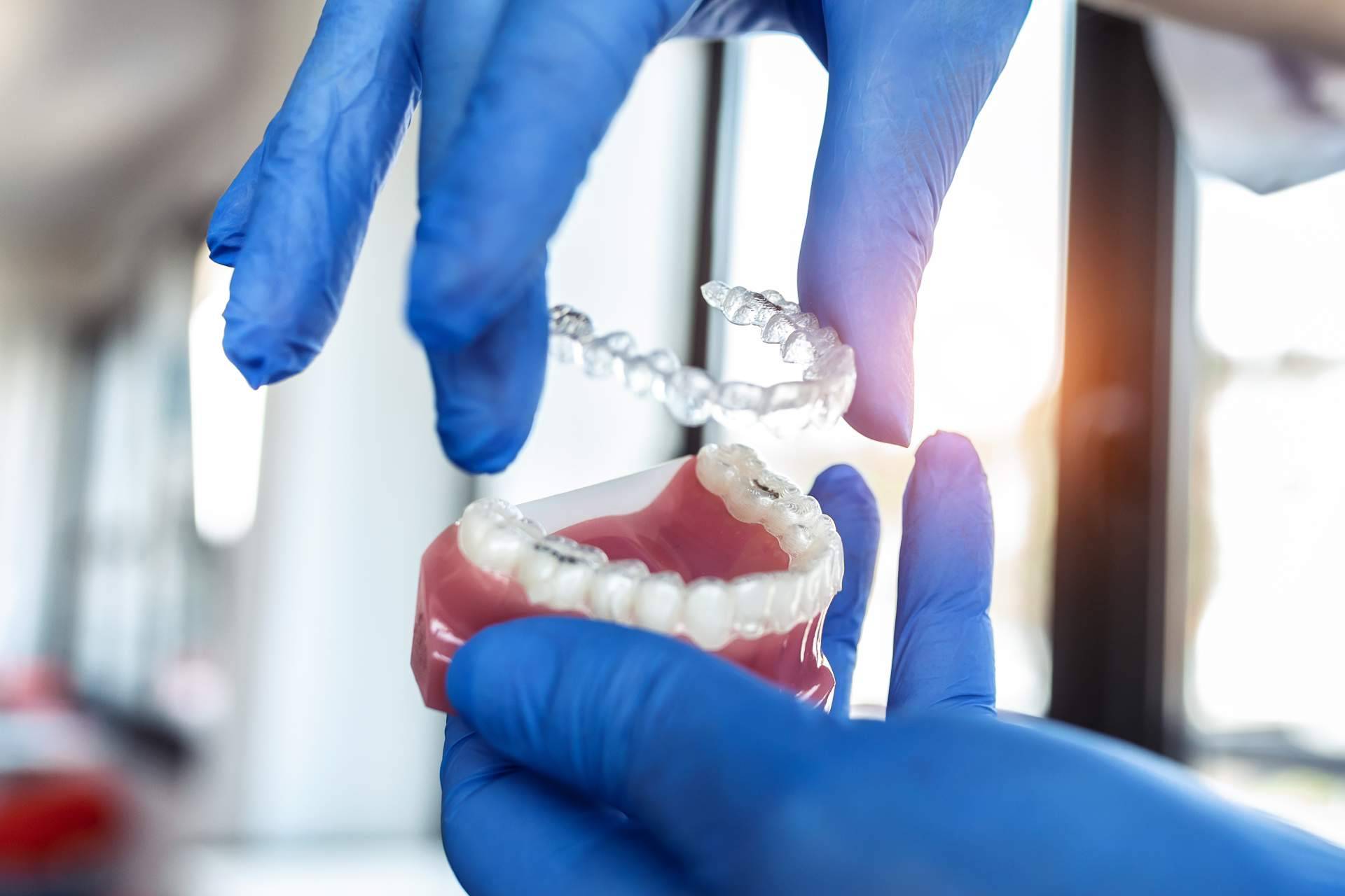 Tratamiento Invisalign a precios competitivos y resultados excepcionales con Clínica InterOralia