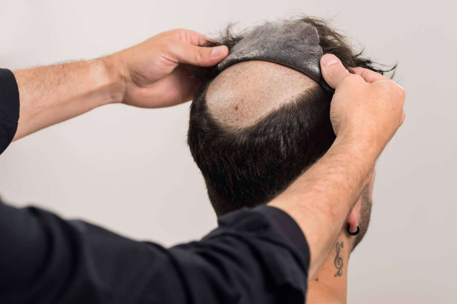 Las prótesis capilares para hombre, un mercado en auge, con Hair Inspira