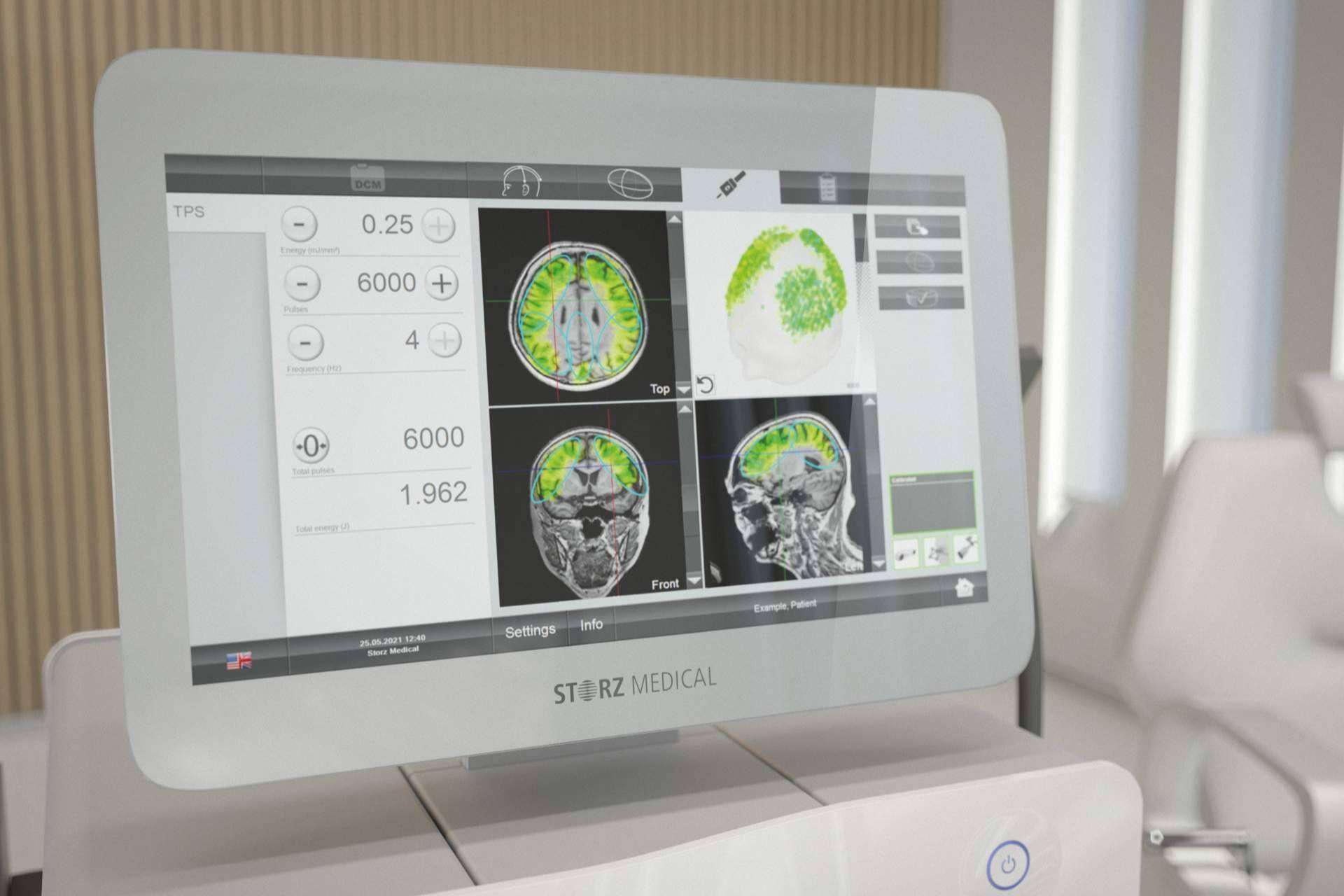 Clínica DKF innova en el tratamiento del Alzheimer en fase temprana