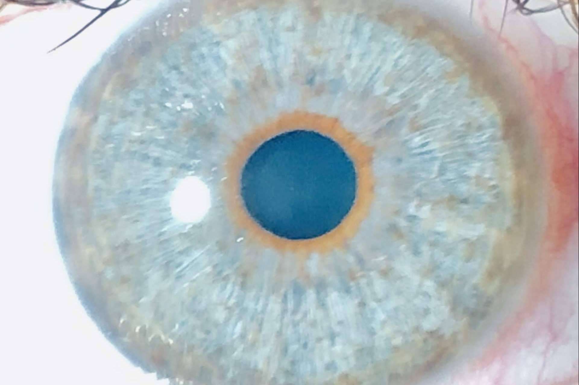 Eyecos estudia la distribución del color de ojos