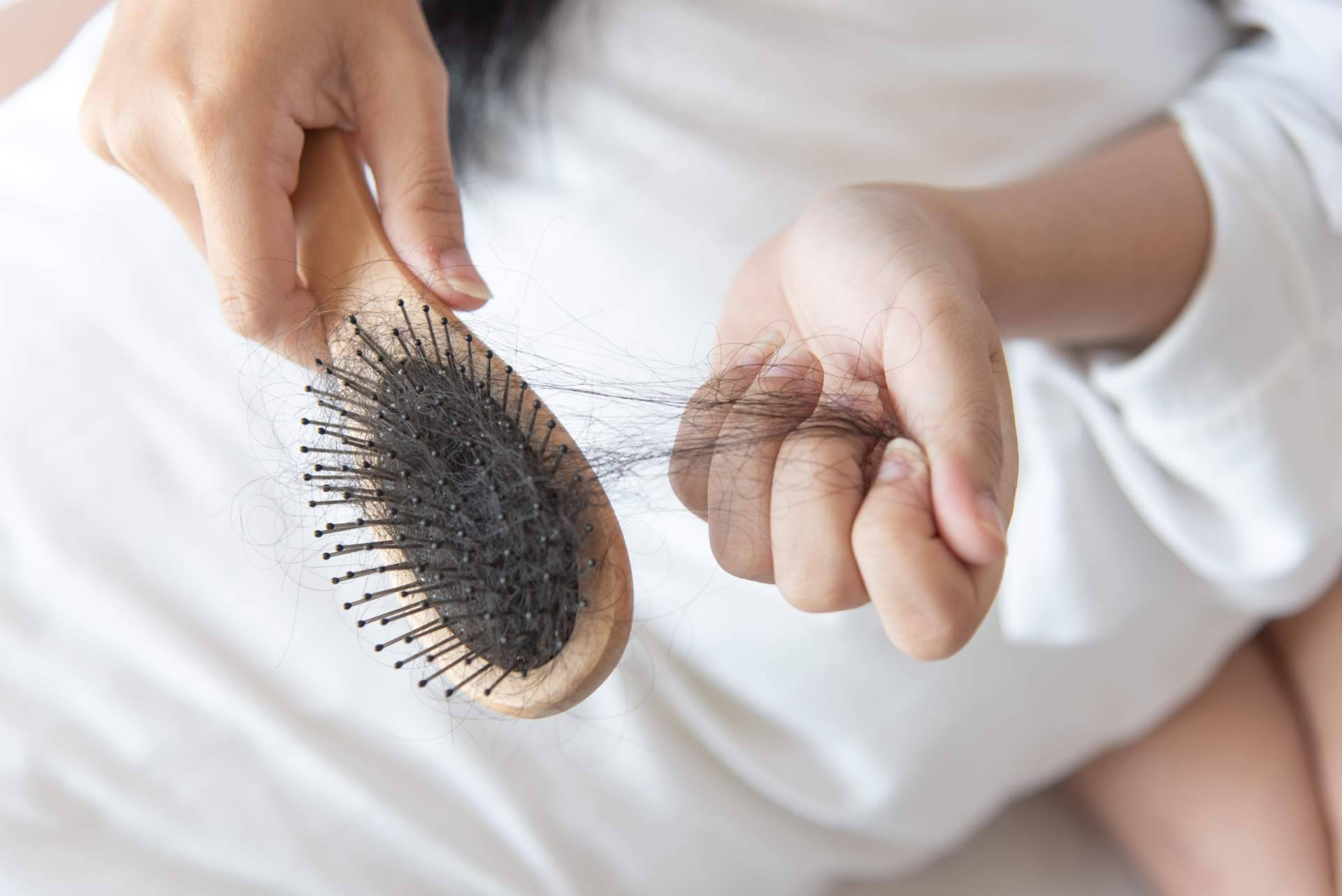 Evocapil y su solución de prevención ante la pérdida del cabello