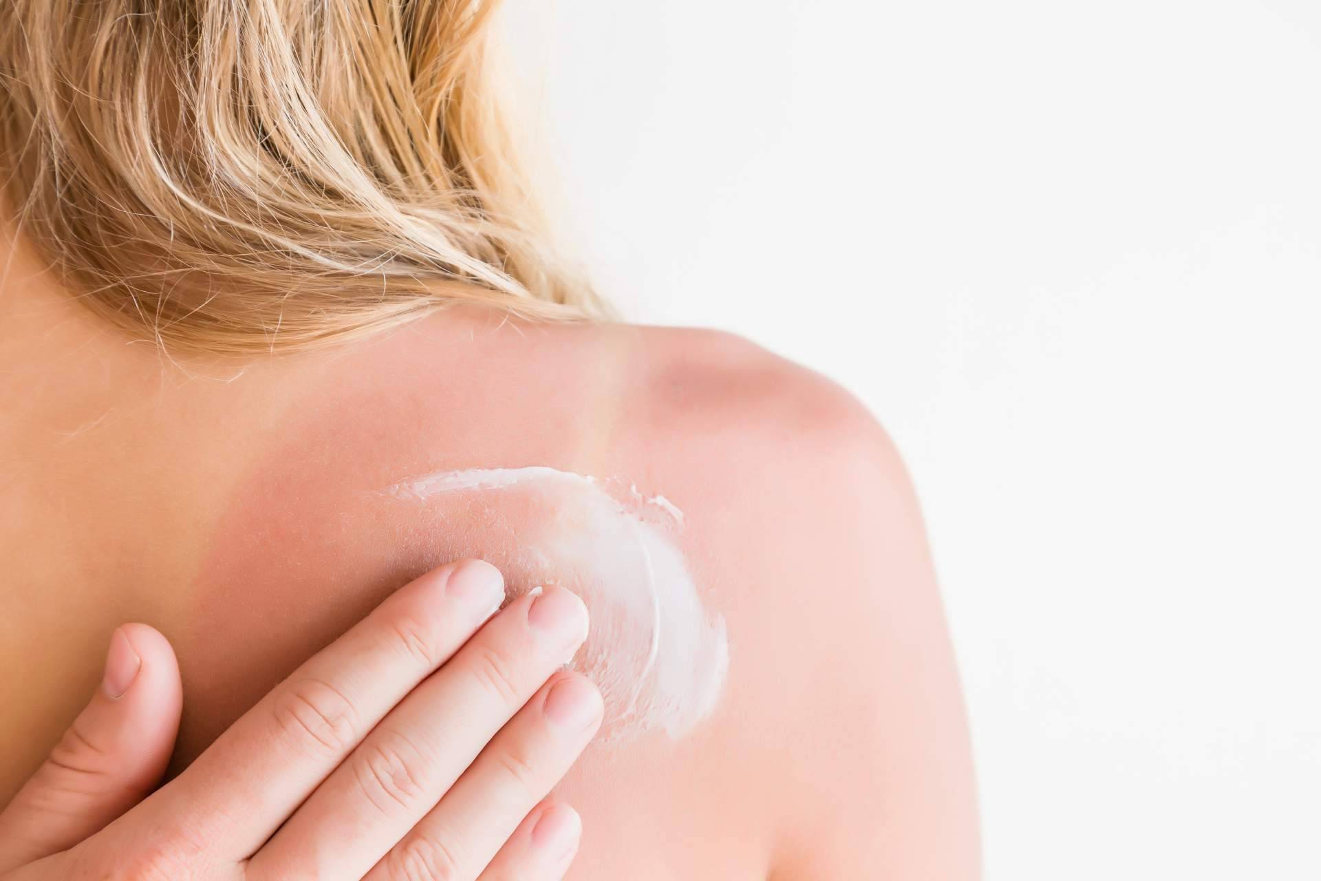 ¿Cómo se utiliza el after sun? Los consejos de Farmasky