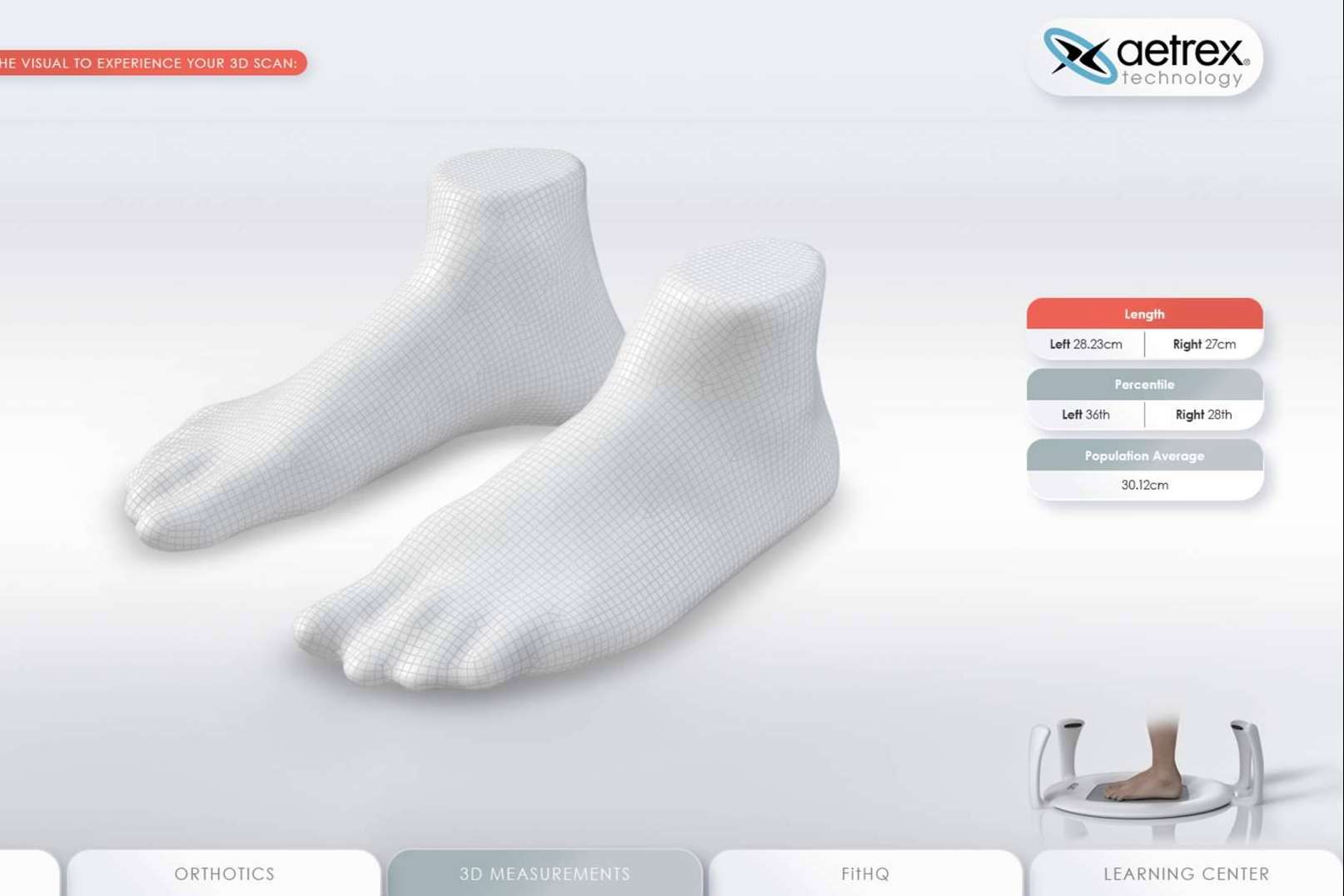 Las ventajas de las plantillas de running de Aetrex quedan demostradas en un estudio clínico