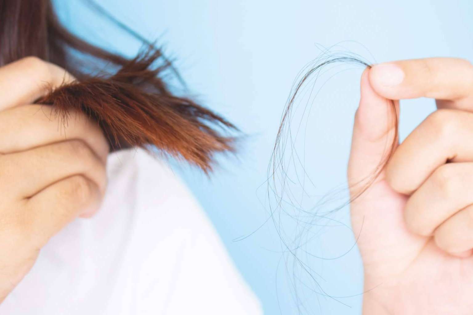 ¿Cómo identificar si se tiene alopecia?