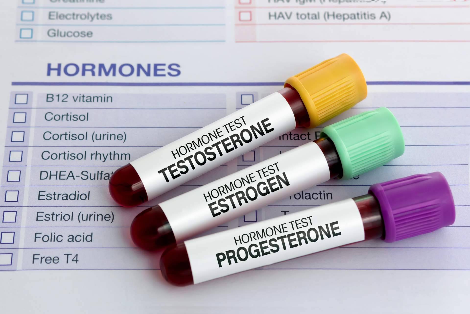 La necesidad de realizarse un análisis de testosterona