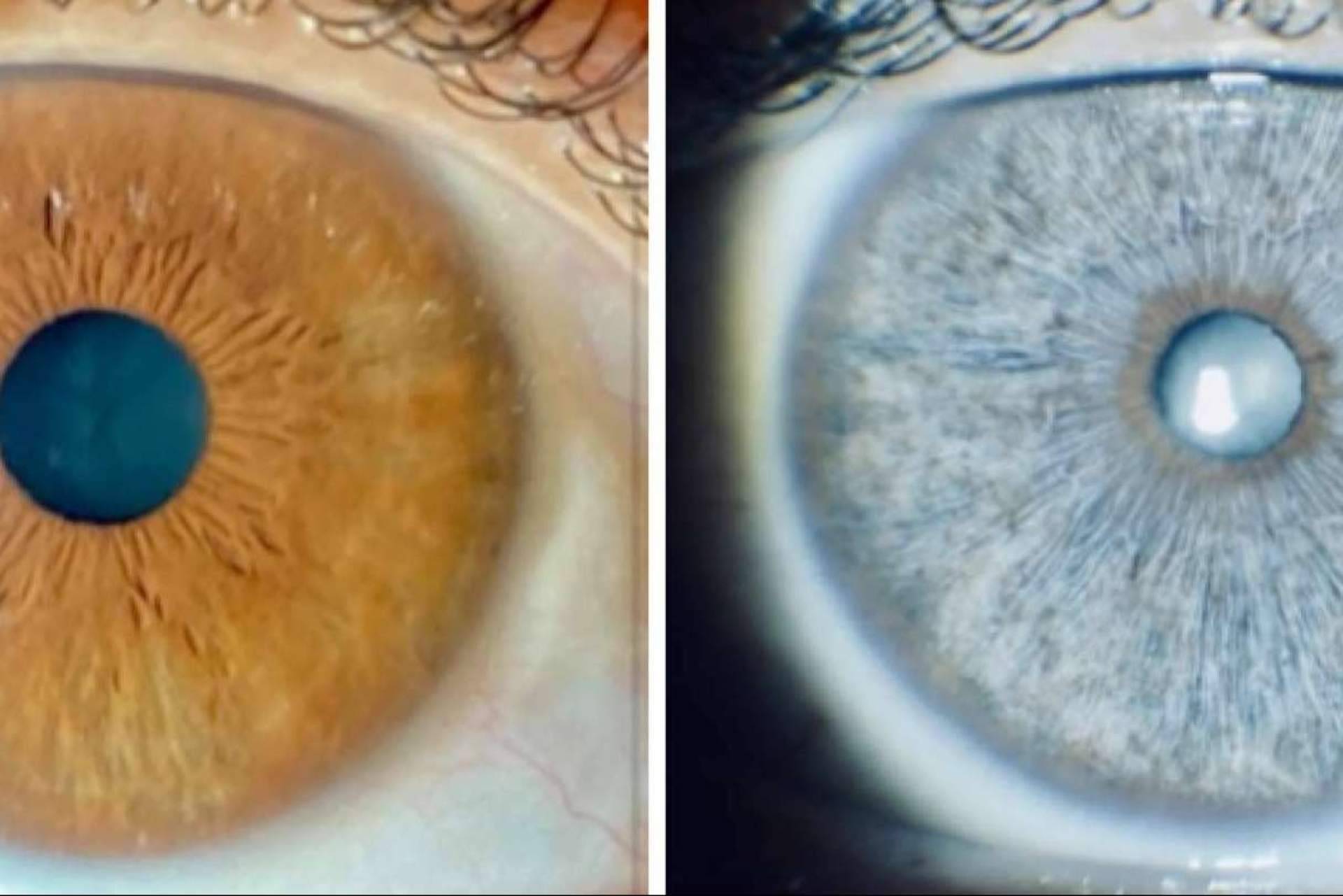 Los sueros crece pestañas pueden oscurecer los párpados y cambiar el color de los ojos