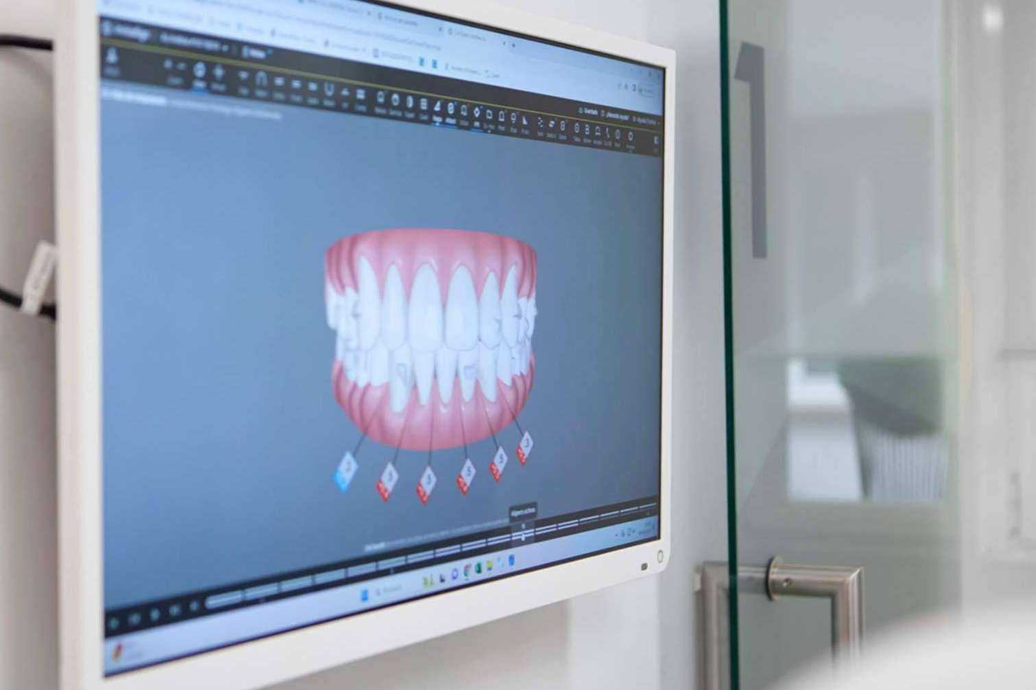 Tratar la maloclusión dental con CLÍNICA CRISTINA VIYUELA + CO y la ortodoncia invisible Invisalign