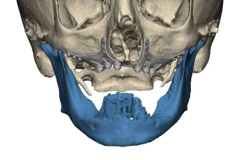 Clínica maxilofacial especializada en cirugías ortognáticas, Clínica Calvo de Mora