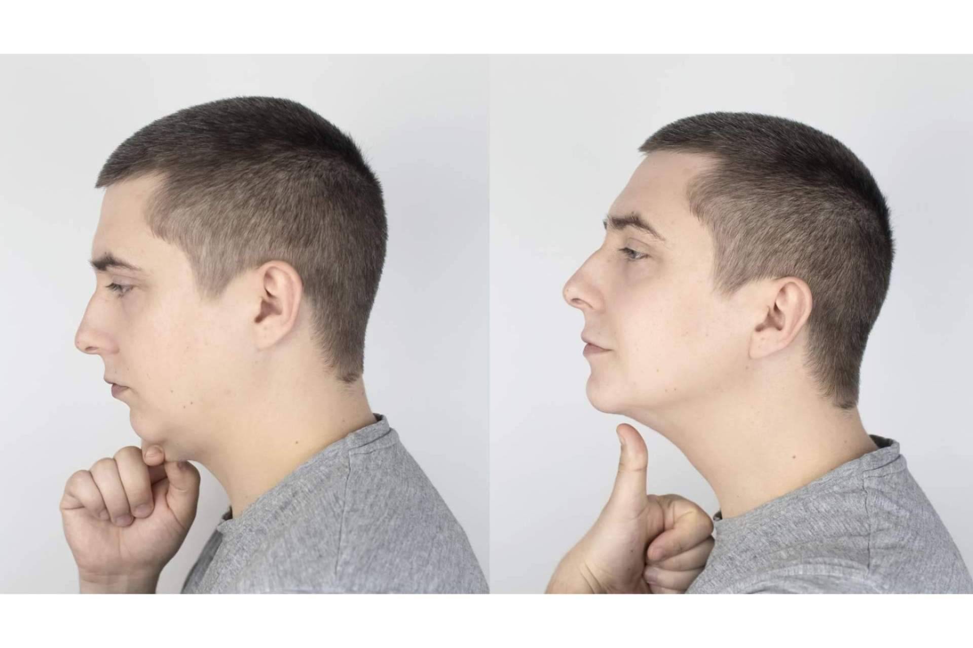 La cirugía lipopapada, disponible en Centro Médico El Pilar