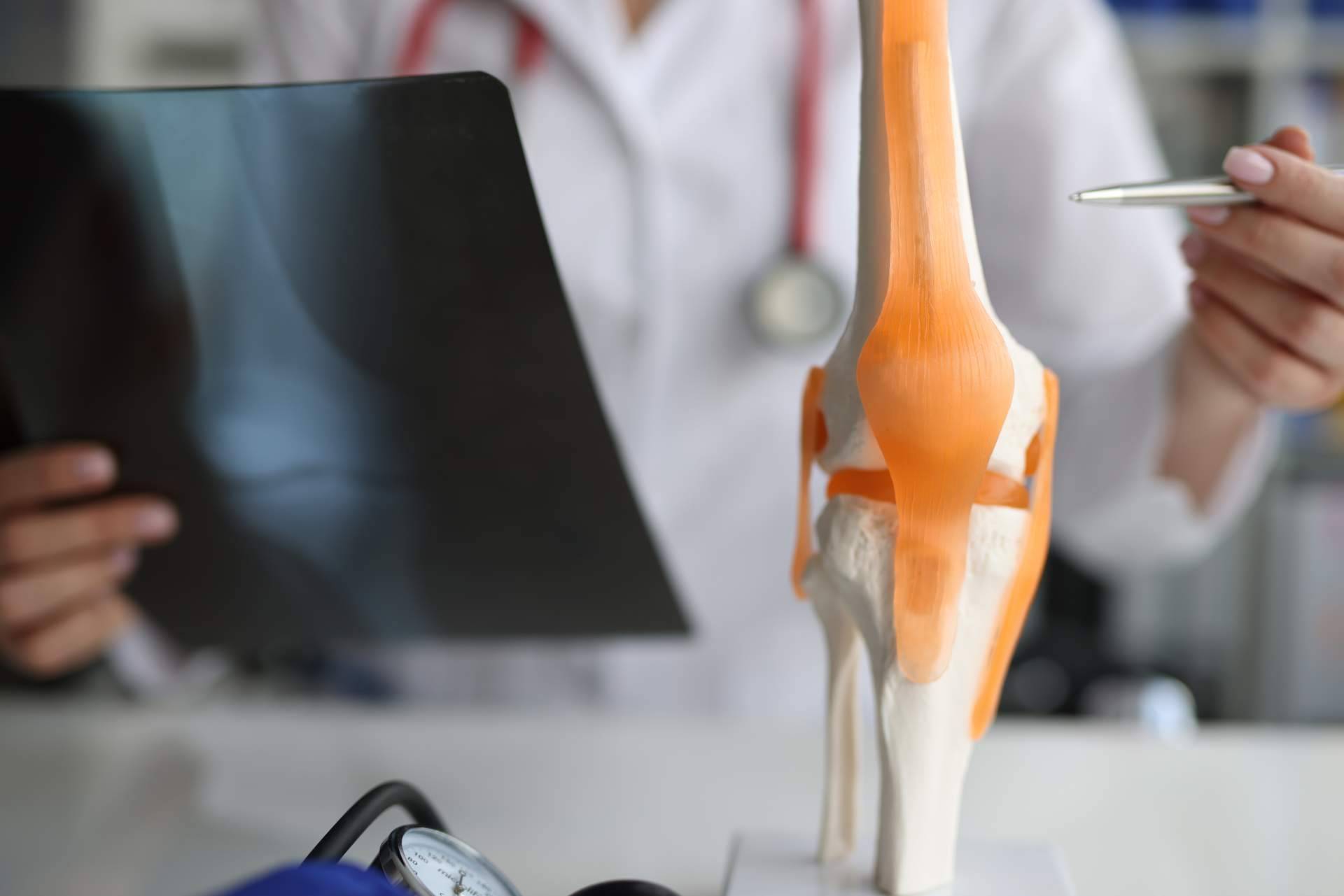 Qué es la tenodesis, por el Dr. Miguel Romero